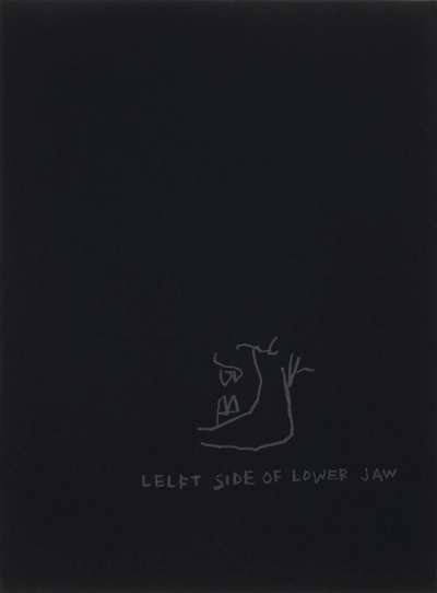 Anatomy, Left Side Of Jaw - Signed Print by Jean-Michel Basquiat 1982 - MyArtBroker