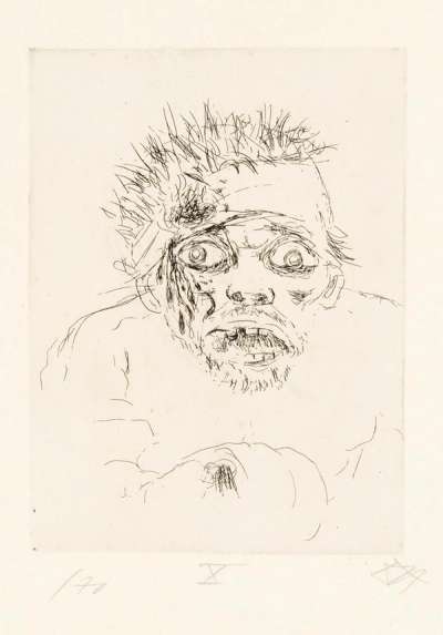 Wounded Man Fleeing - Signed Print by Otto Dix 1924 - MyArtBroker