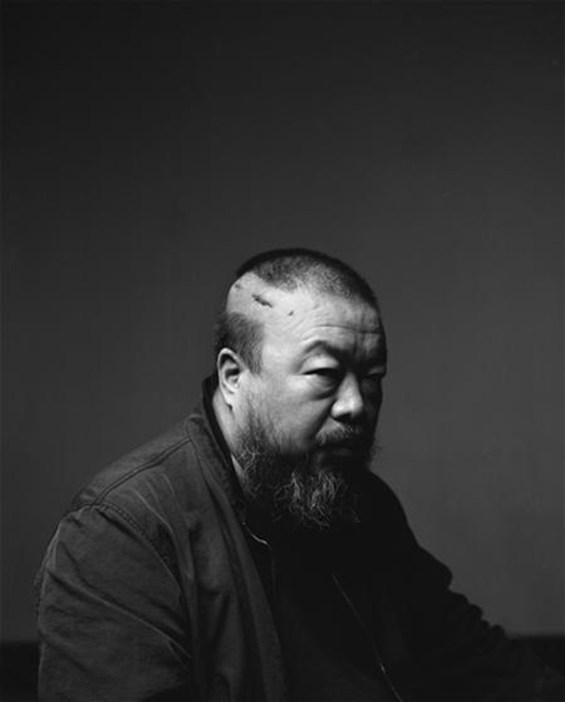 Chinese contemporary artist Ai Weiwei photographed in black and white with a scar on his head exposed