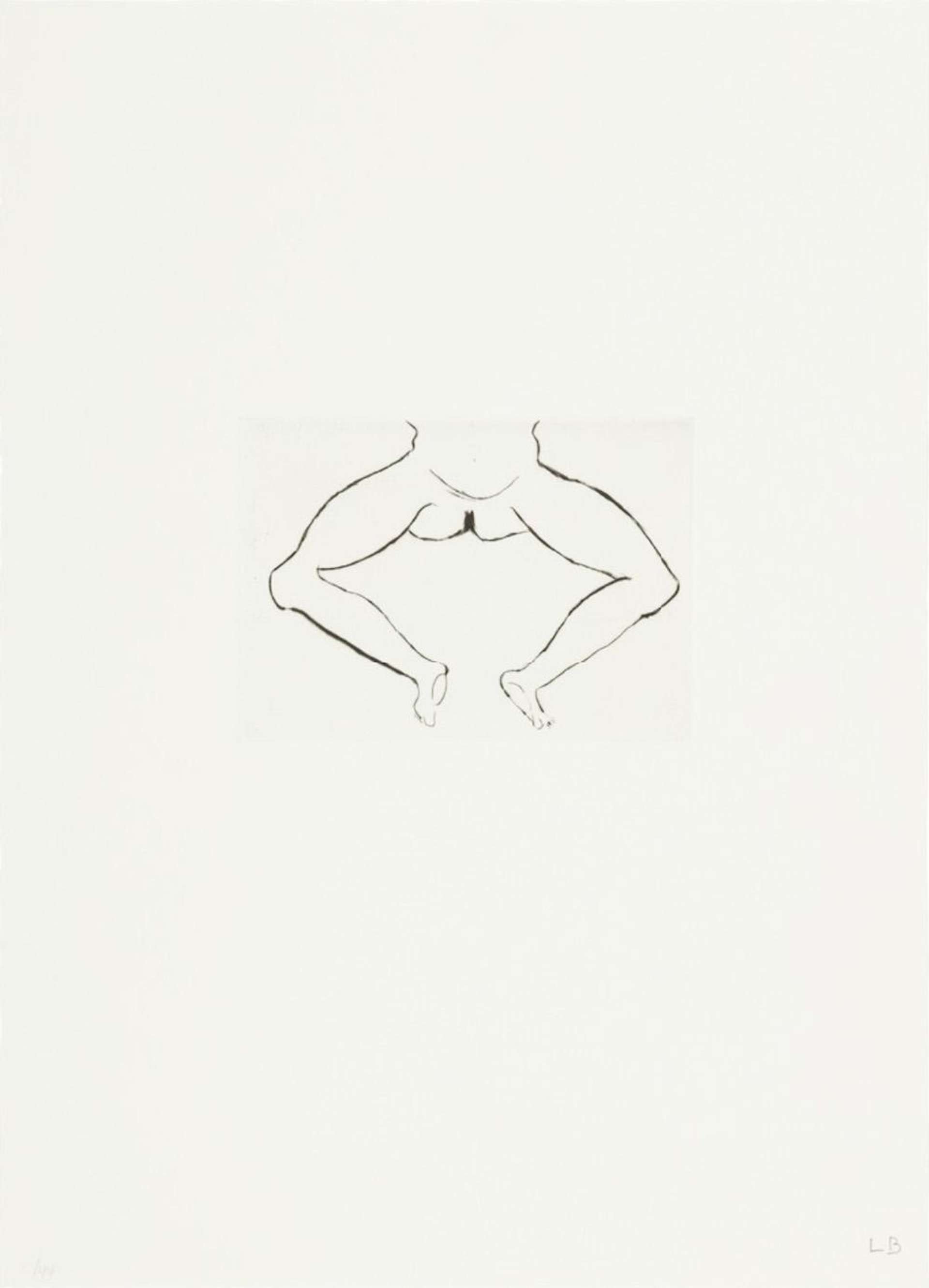 Louise Bourgeois Untitled No. 7. A monochromatic etching of a depiction of the nude lower half of a woman’s body.