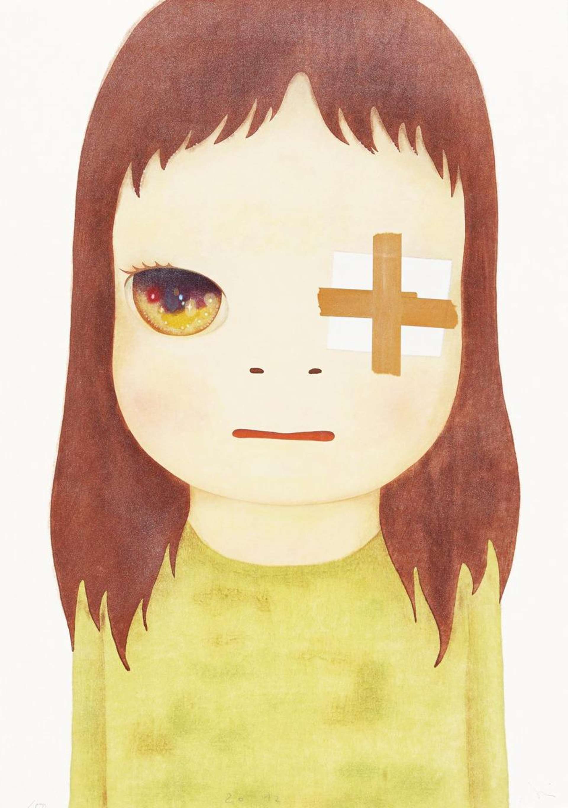 Yoshitomo Nara’s Untitled (Eye Patch). A woodcut print of a girl with eye covered with bandage Yoshitomo Nara’s Untitled (Eye Patch). A woodcut print of a girl with eye covered with bandage 