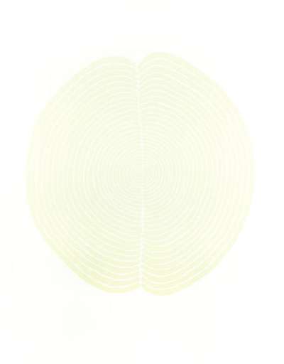 Brain Field - Signed Print by Antony Gormley 2007 - MyArtBroker