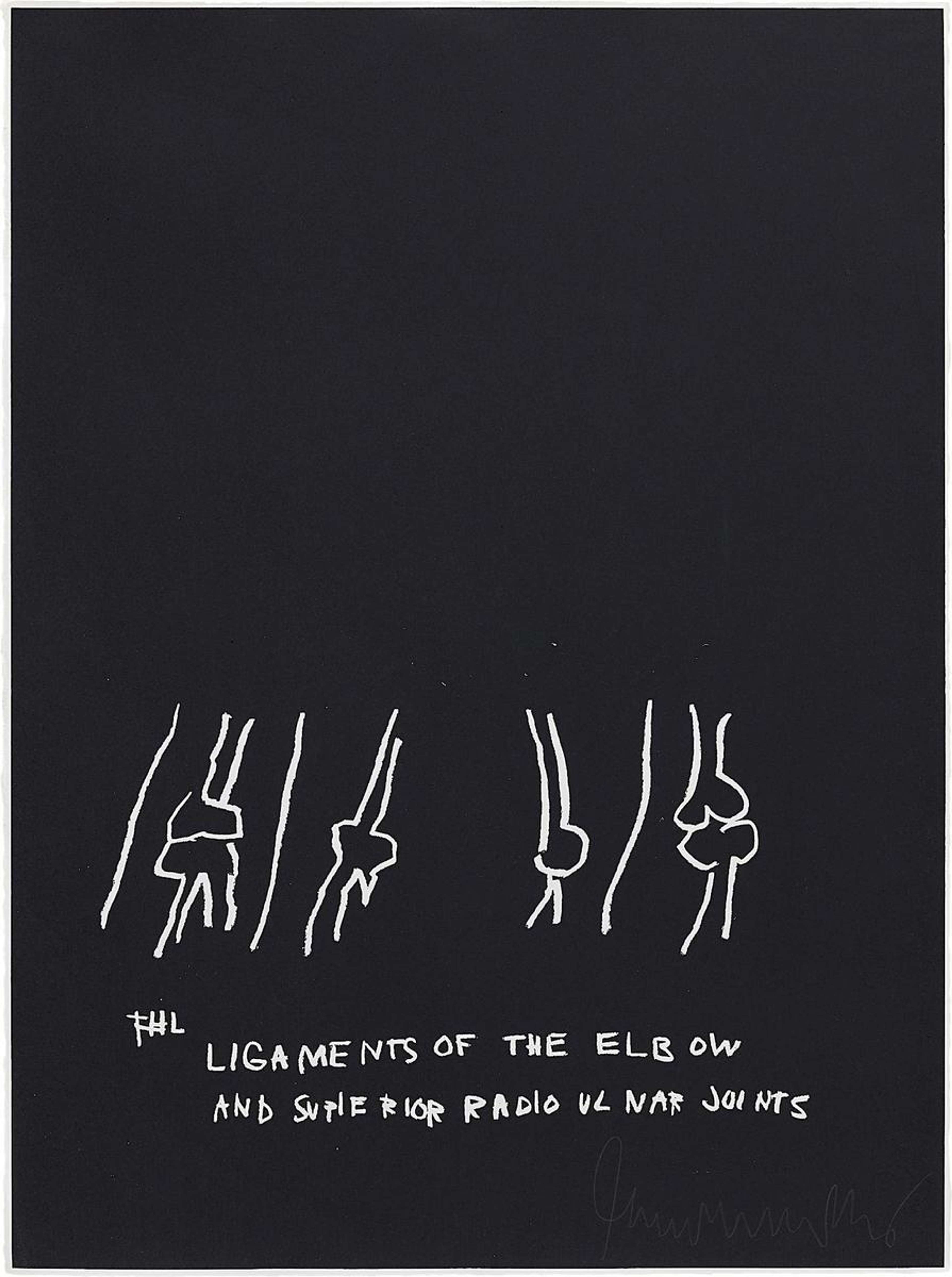 Anatomy, Ligaments Of The Elbow - Signed Print by Jean-Michel Basquiat 1982 - MyArtBroker