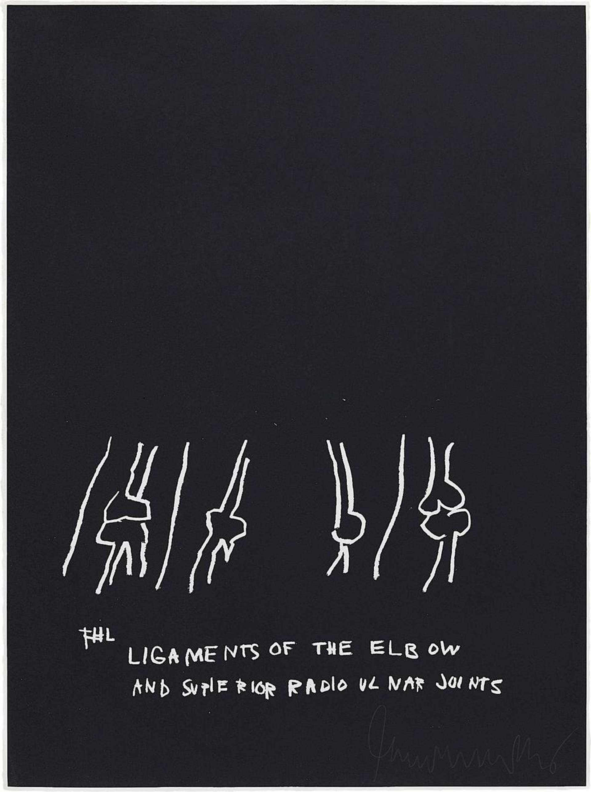 Anatomy, Ligaments Of The Elbow - Signed Print by Jean-Michel Basquiat 1982 - MyArtBroker