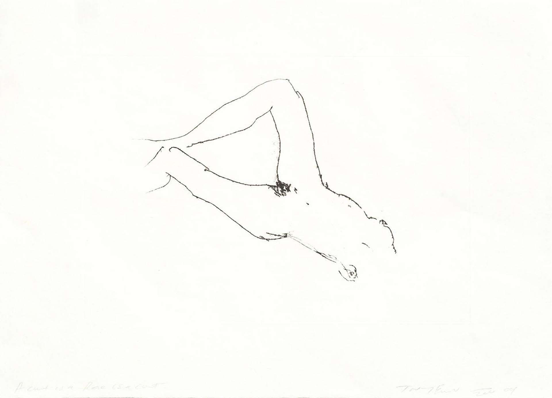 An etching by Tracey Emin depicting woman’s torso and pelvis, with the bottom of her legs and head omitted.