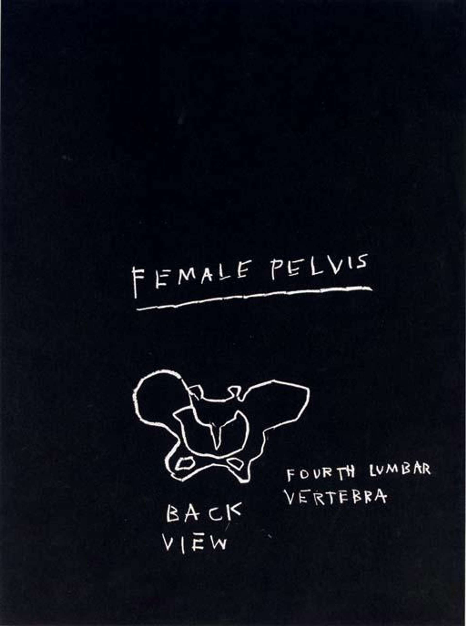 Jean-Michel Basquiat’s Anatomy, Female Pelvis. A black screenprint featuring white anatomical drawings of a human female pelvis with descriptive labels.