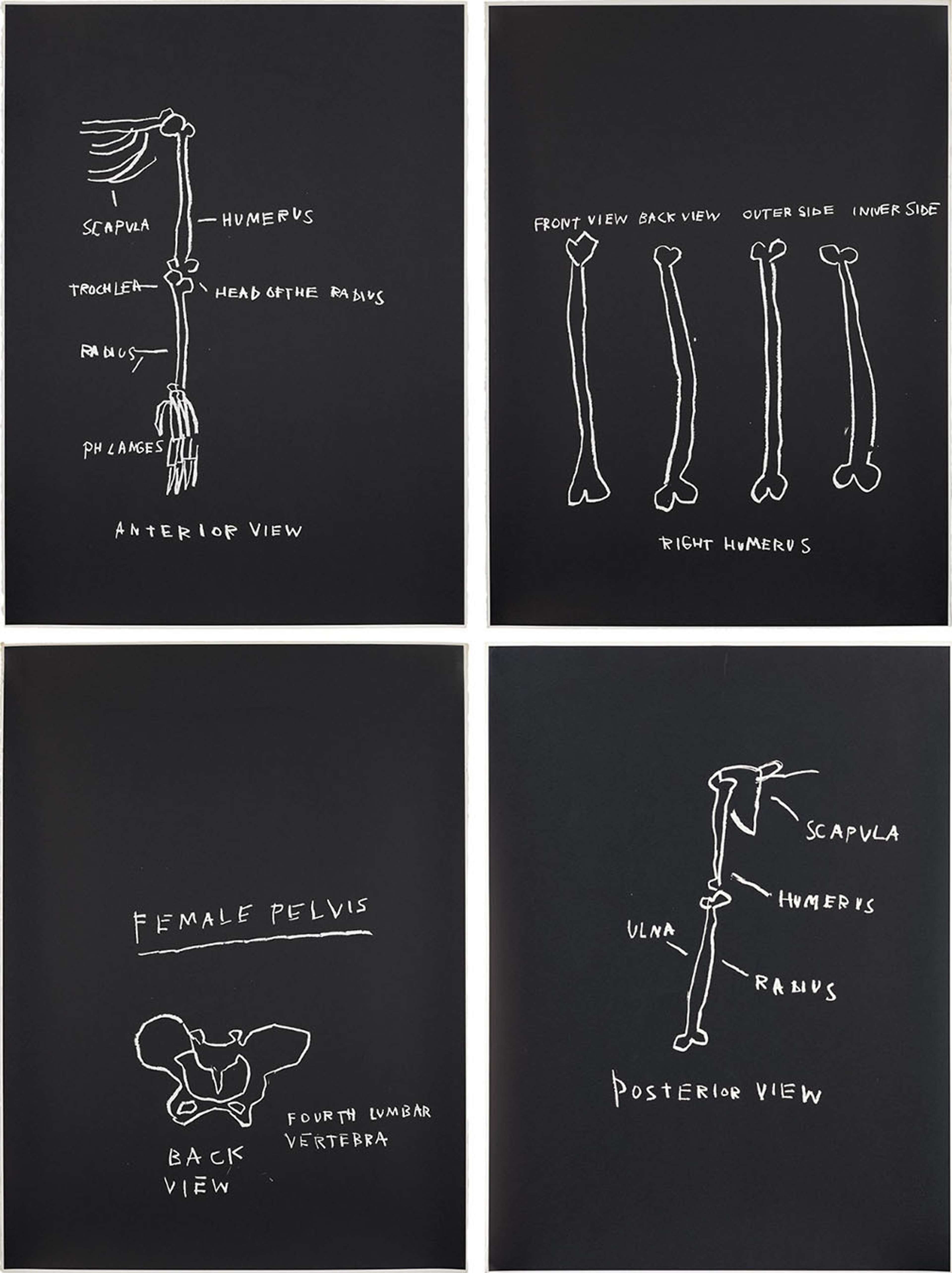 Four screen prints in black with white ink, each depicting anatomical studies with the artist's annotations.