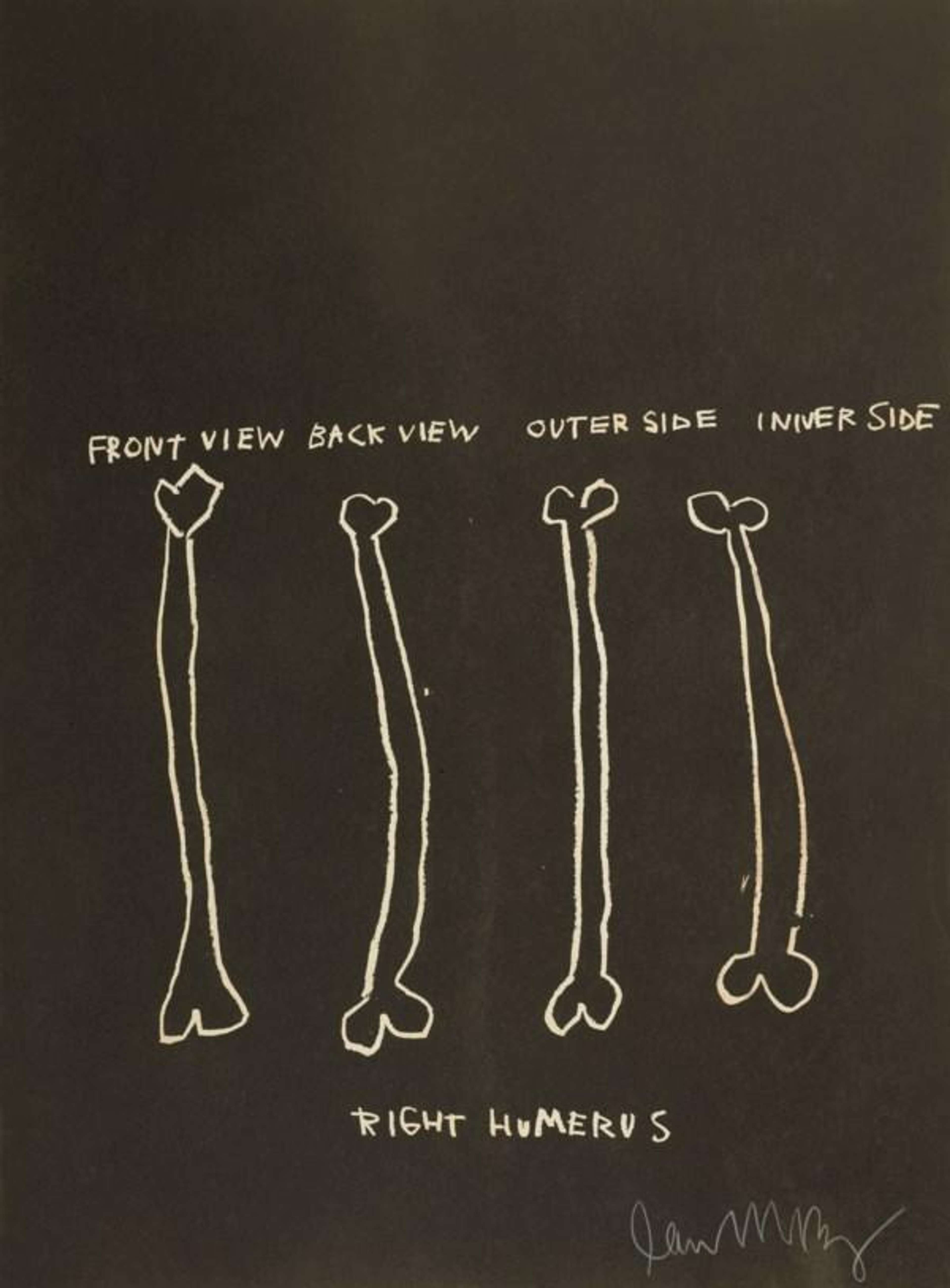 Anatomy, Right Humerus - Signed Print by Jean-Michel Basquiat 1982 - MyArtBroker