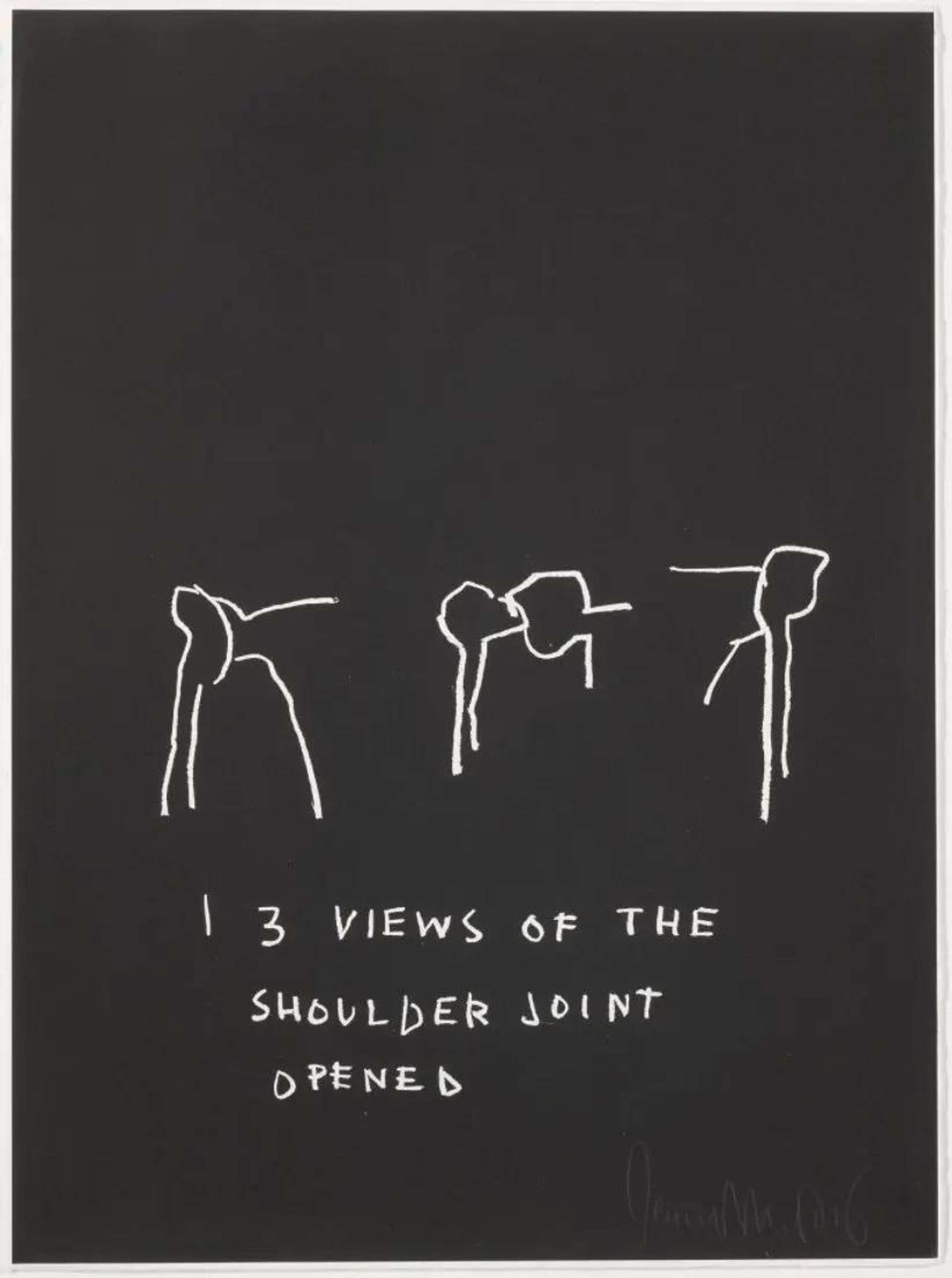 Jean-Michel Basquiat’s Anatomy, 3 Views Of The Shoulder Joint Opened. A black screenprint featuring white drawings of a human shoulder joint with descriptive labels.