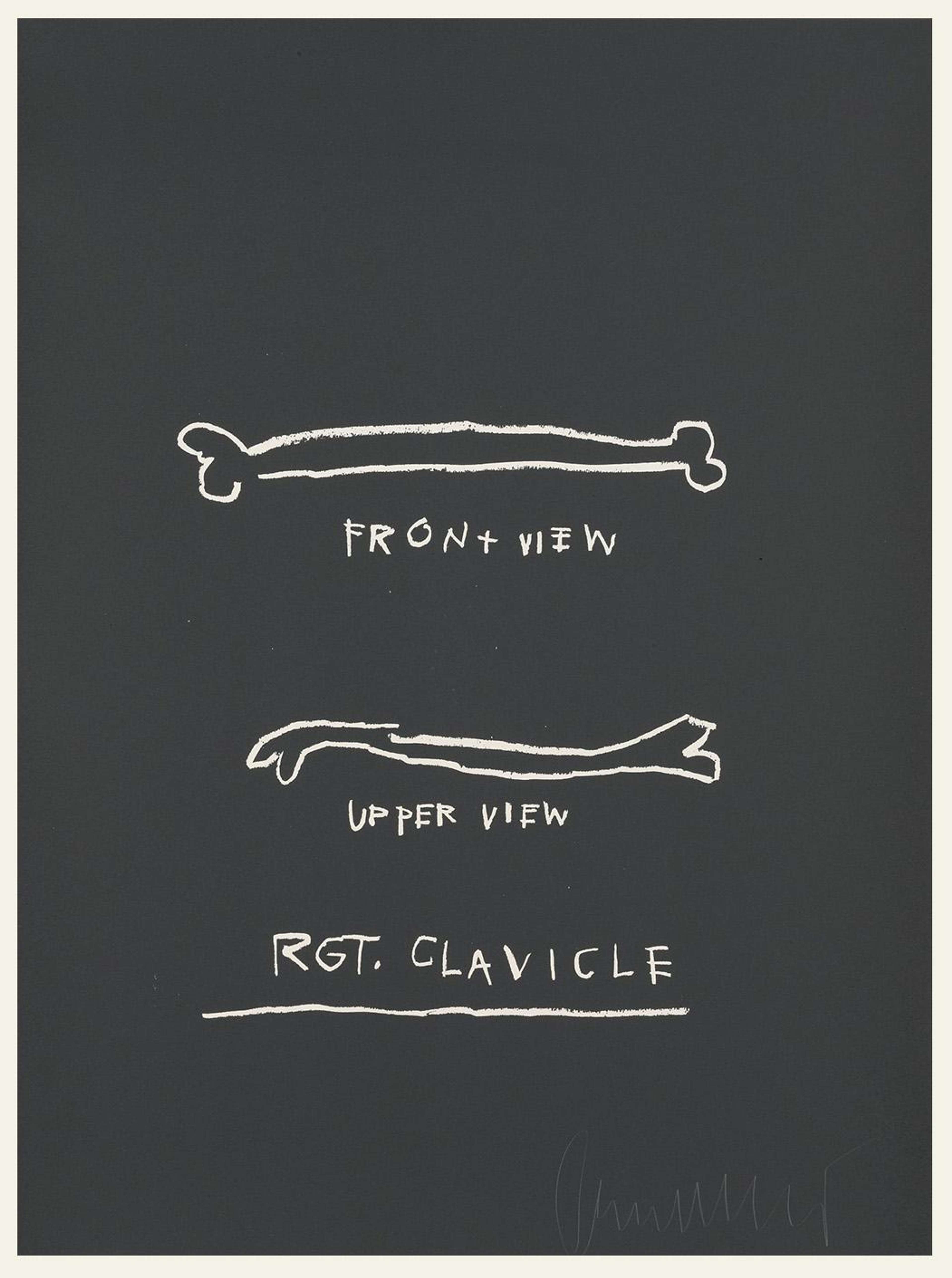 A screenprint by Jean-Michel Basquiat depicting bones and text in white against a black background.