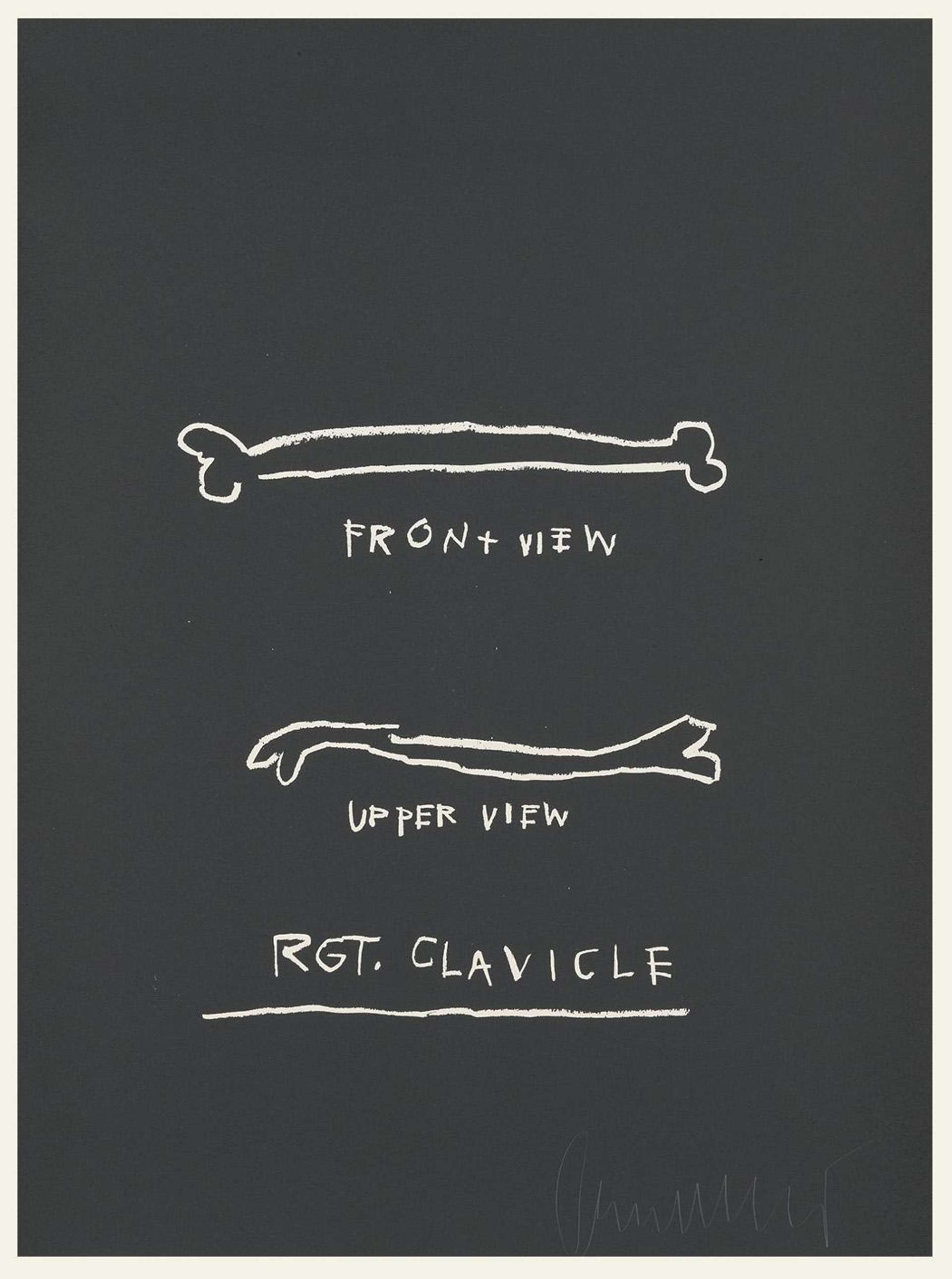 A screenprint by Jean-Michel Basquiat depicting bones and text in white against a black background.