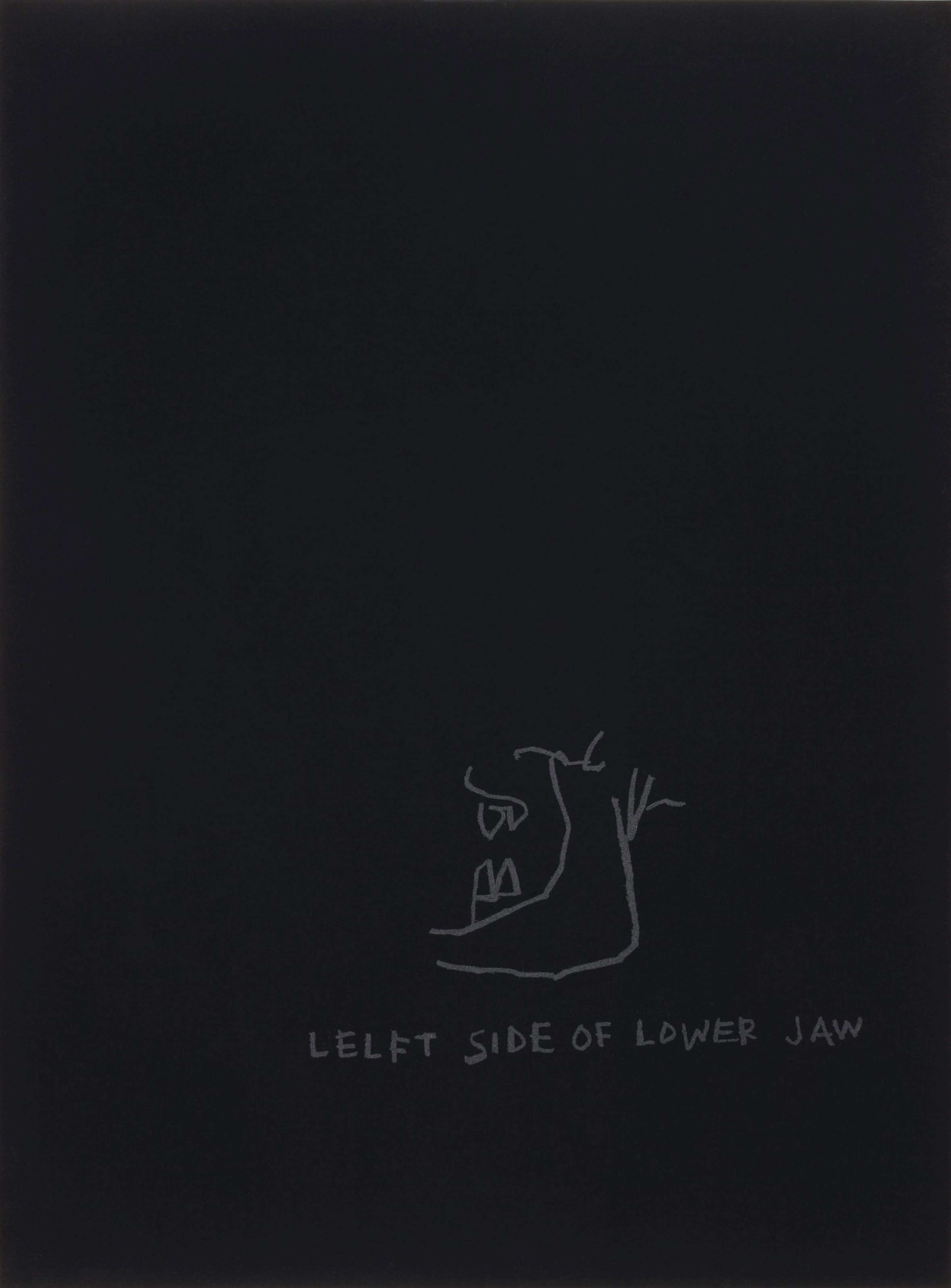 Jean-Michel Basquiat’s Anatomy, Left Side Of Jaw. A black screenprint featuring grey anatomical drawings of the side profile of a jaw bone with descriptive labels.