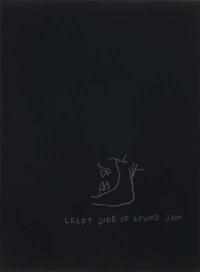 Anatomy, Left Side Of Jaw - Signed Print by Jean-Michel Basquiat 1982 - MyArtBroker