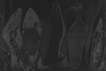 Diamond Dust Shoes (F. & S. II.256) - Signed Print