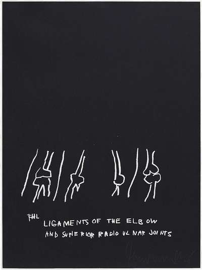 Anatomy, Ligaments Of The Elbow - Signed Print by Jean-Michel Basquiat 1982 - MyArtBroker