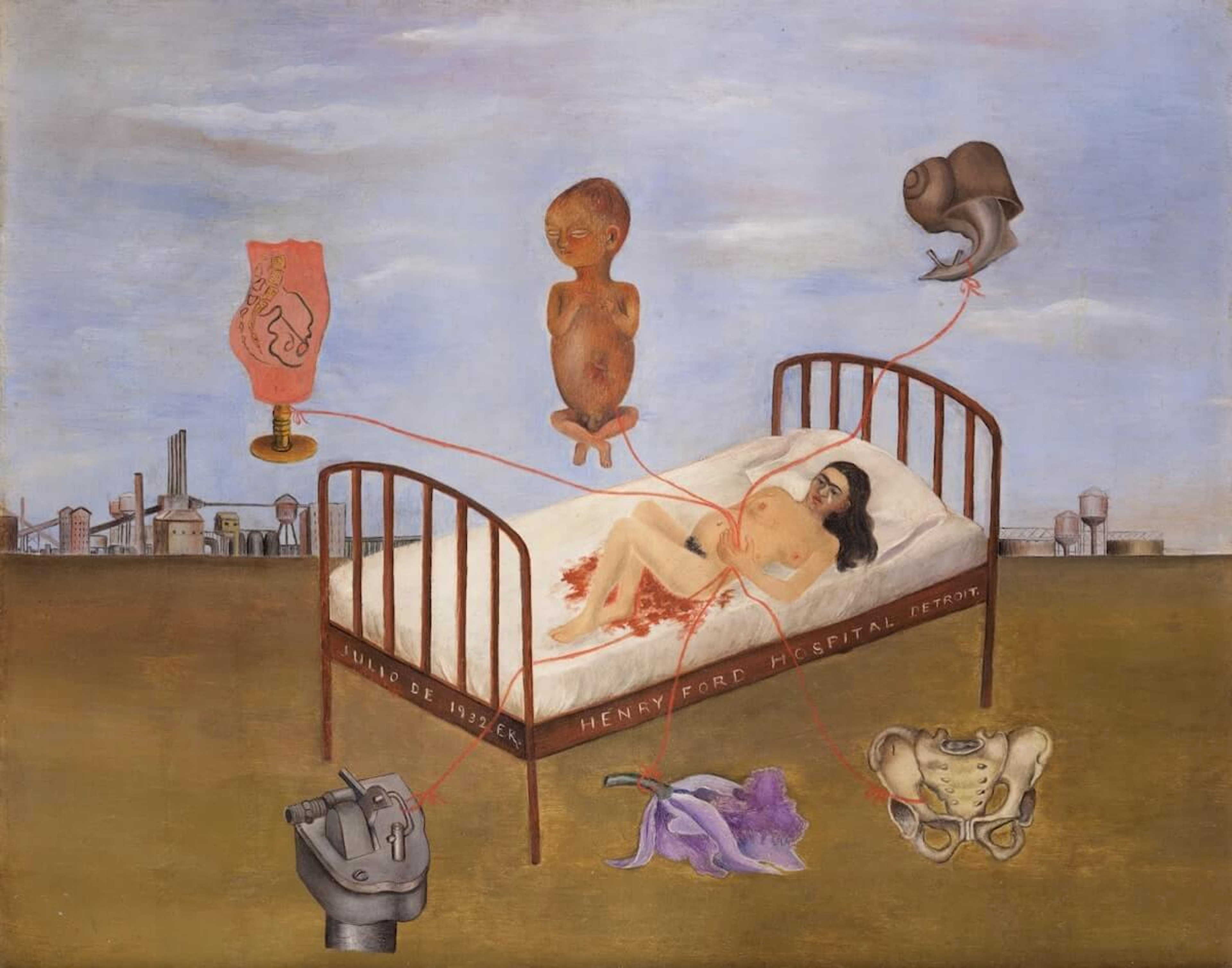 Une image de l'œuvre « Henry Ford Hospital » de Frida Kahlo. L'artiste est représentée nue, allongée sur un lit d'hôpital, avec six objets flottant autour d'elle, notamment un fœtus masculin, un escargot et un os pelvien.