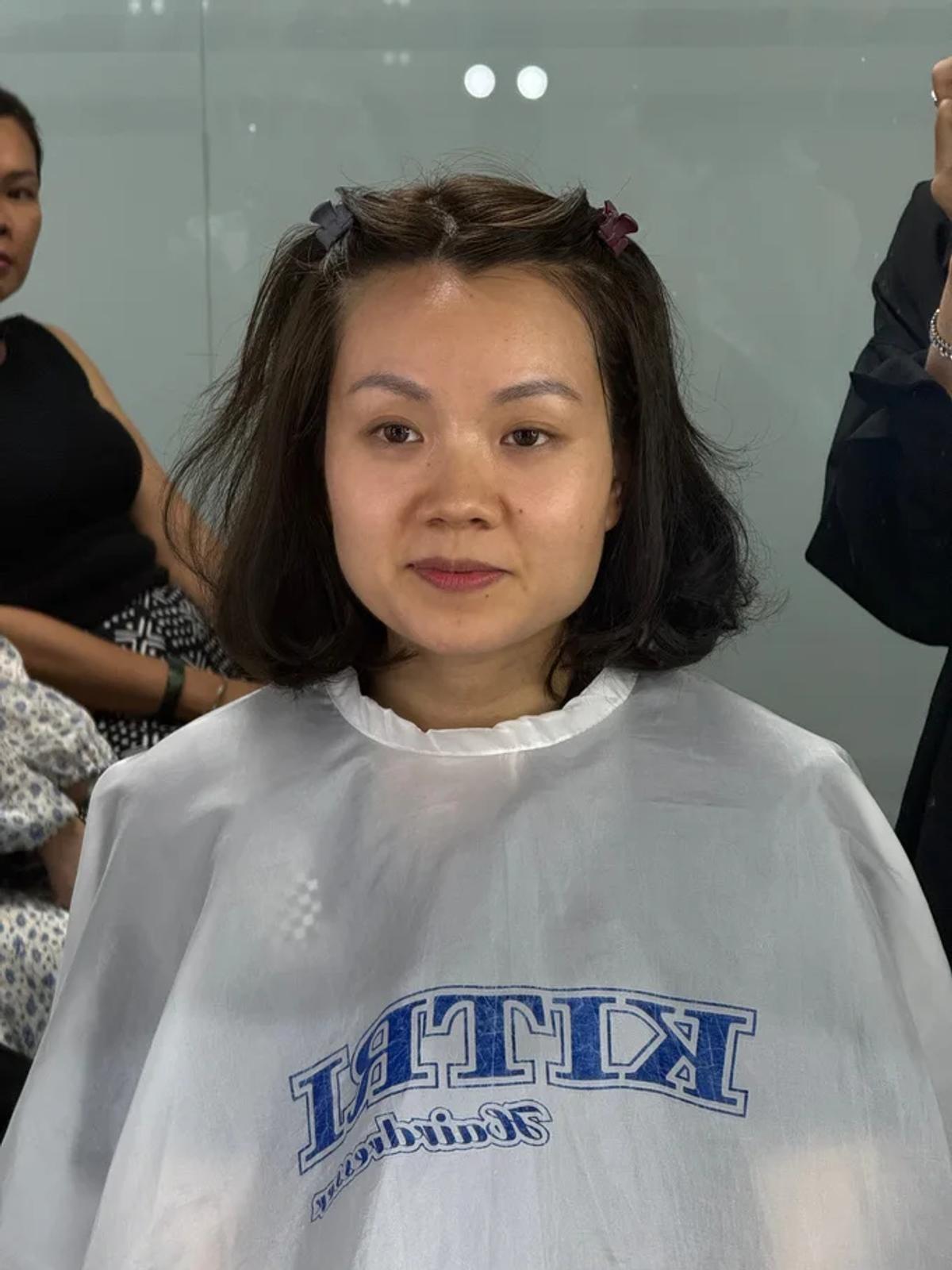 Before của HV Katherine Vo trong case học viên.