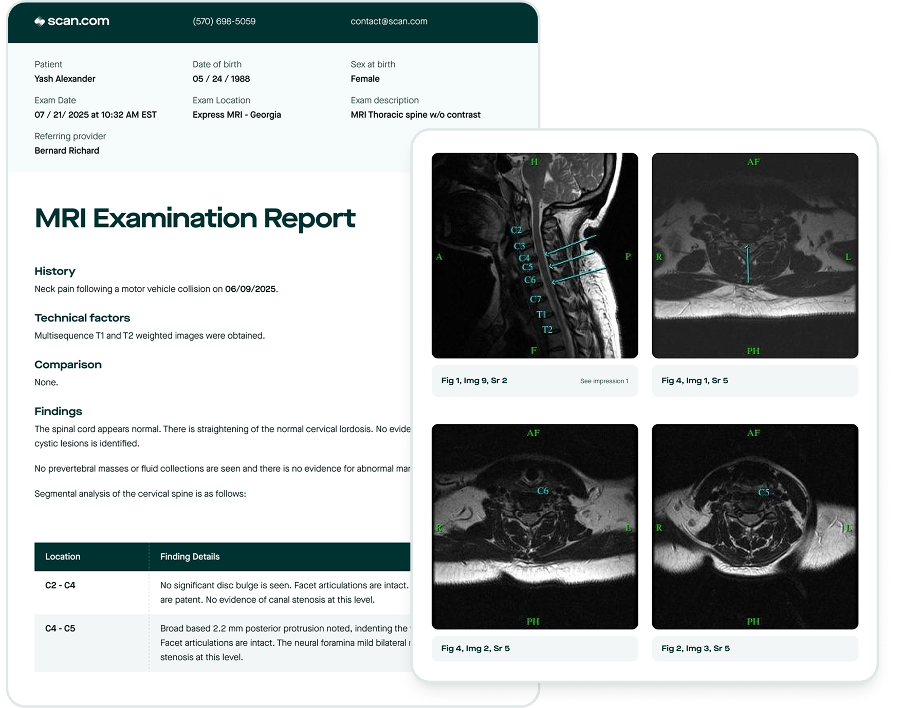 Get your scan results