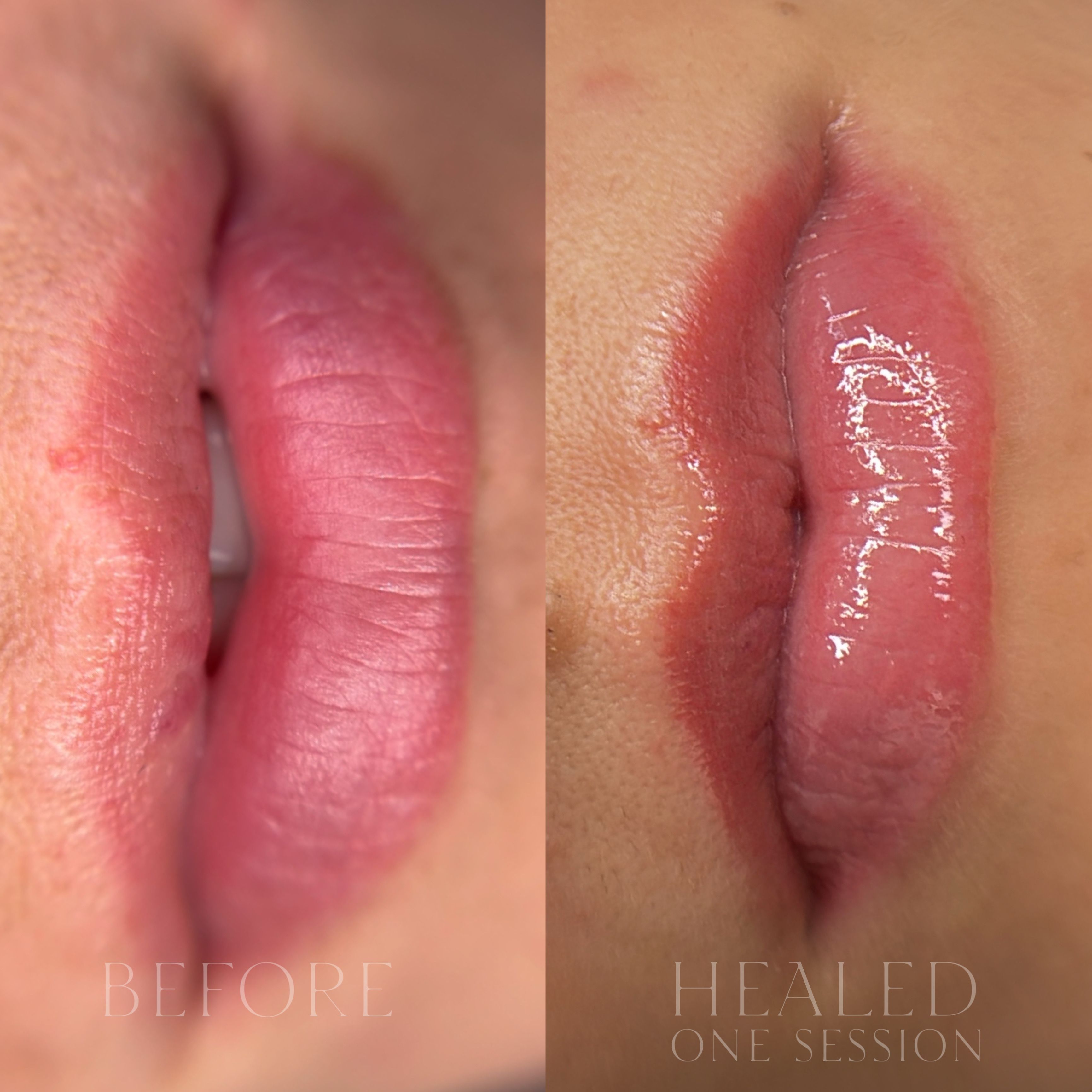 Lip Blush before and after