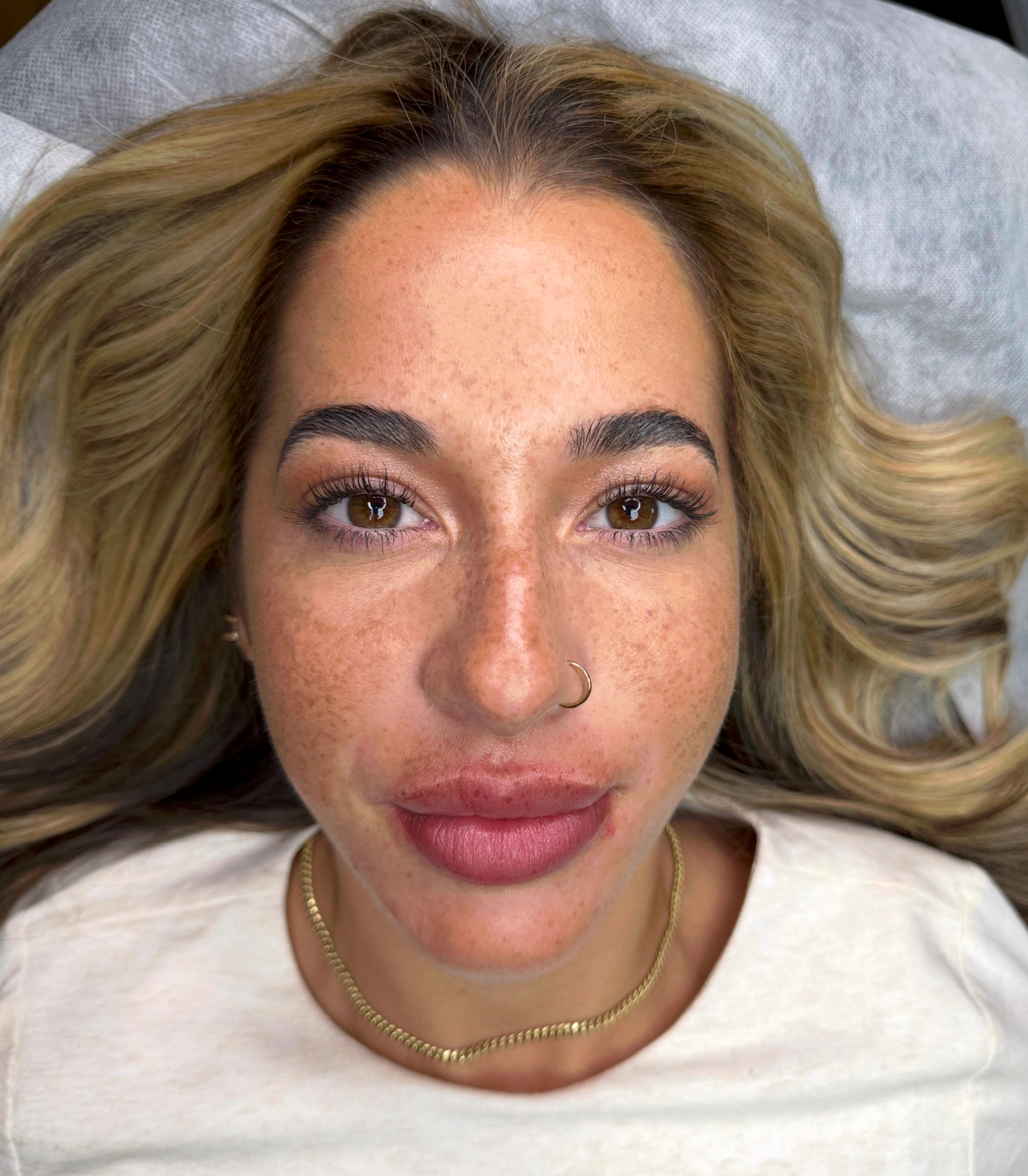 Overhead close-up of a woman with light, freckled skin and blonde hair lying on a treatment bed before a permanent tinted lip blush procedure. Her lips show their natural soft pink tone, providing a before-treatment reference. Her brows are well-groomed with a natural, defined shape featuring fine hair strokes. She has warm brown eyes, long lashes, a small gold nose ring, a gold stud earring, a gold chain necklace, and wears a white top. The symmetrical, straight-on angle captures her full face in studio lighting.