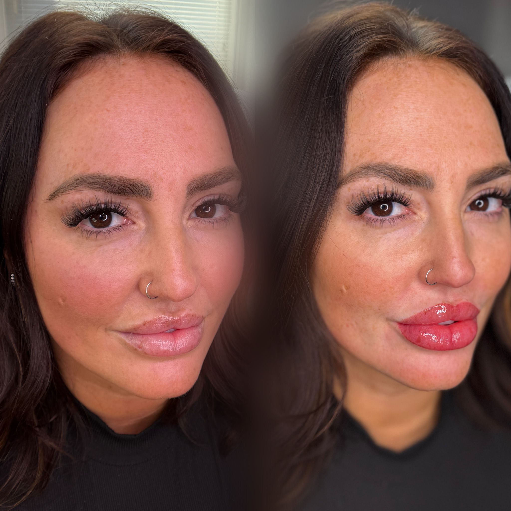 Before and After Lip Blush done by Alexa Nika (@bostonbrowsociety) at MOKO Beauty