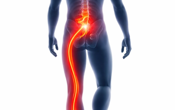 The Truth About Sciatica: Real Causes, Disc Problems, and Proven Treatments in Mesa
