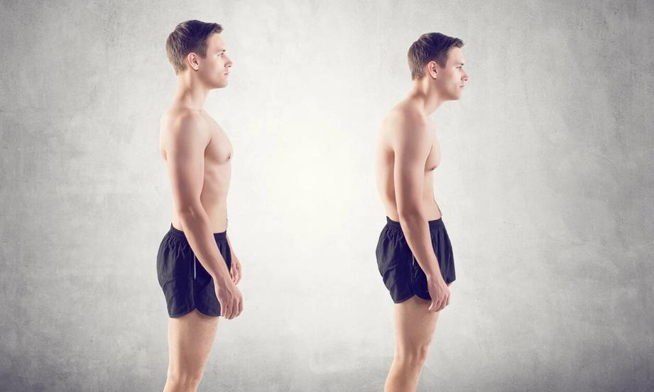 bad posture