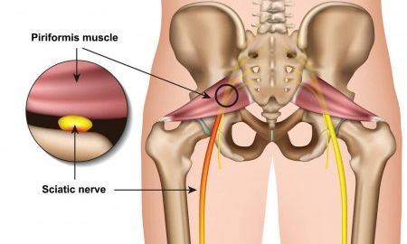 piriformis_muscle