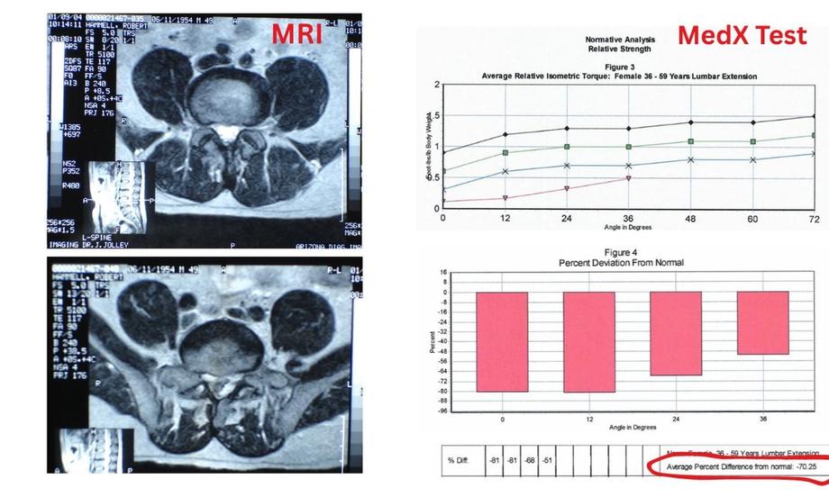 Split-screen graphic MRI vs MedX