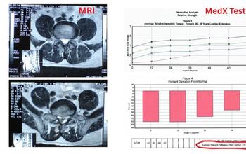 Split-screen graphic MRI vs MedX