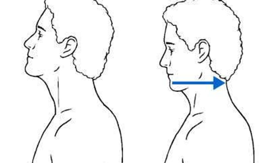 Chin Tucks: Tips and Recommended Variations