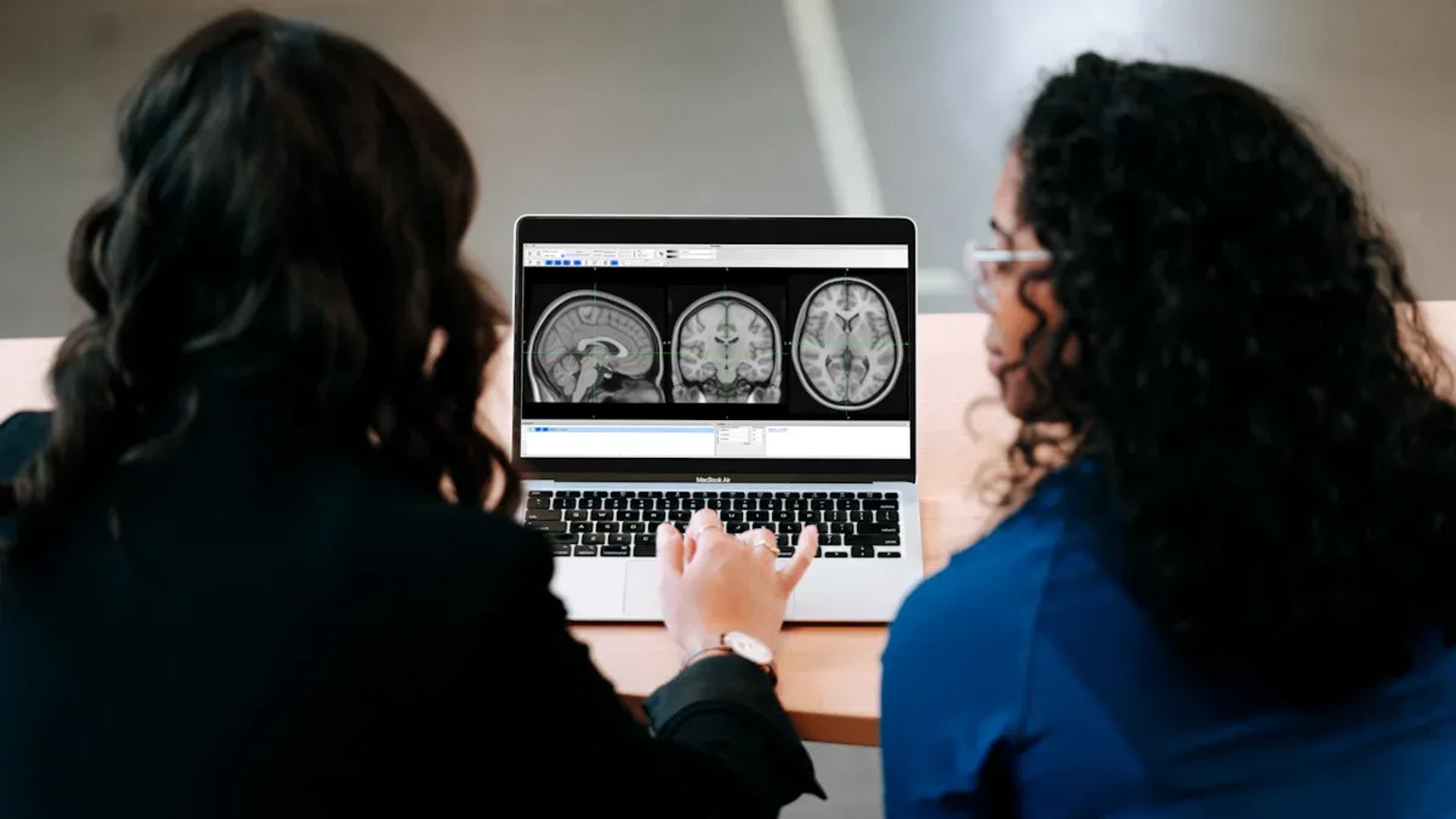 How AI Is Revolutionizing Medical Image Analysis in 2025