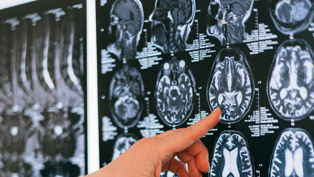 Real-World Impact of AI in Medical Image Analysis