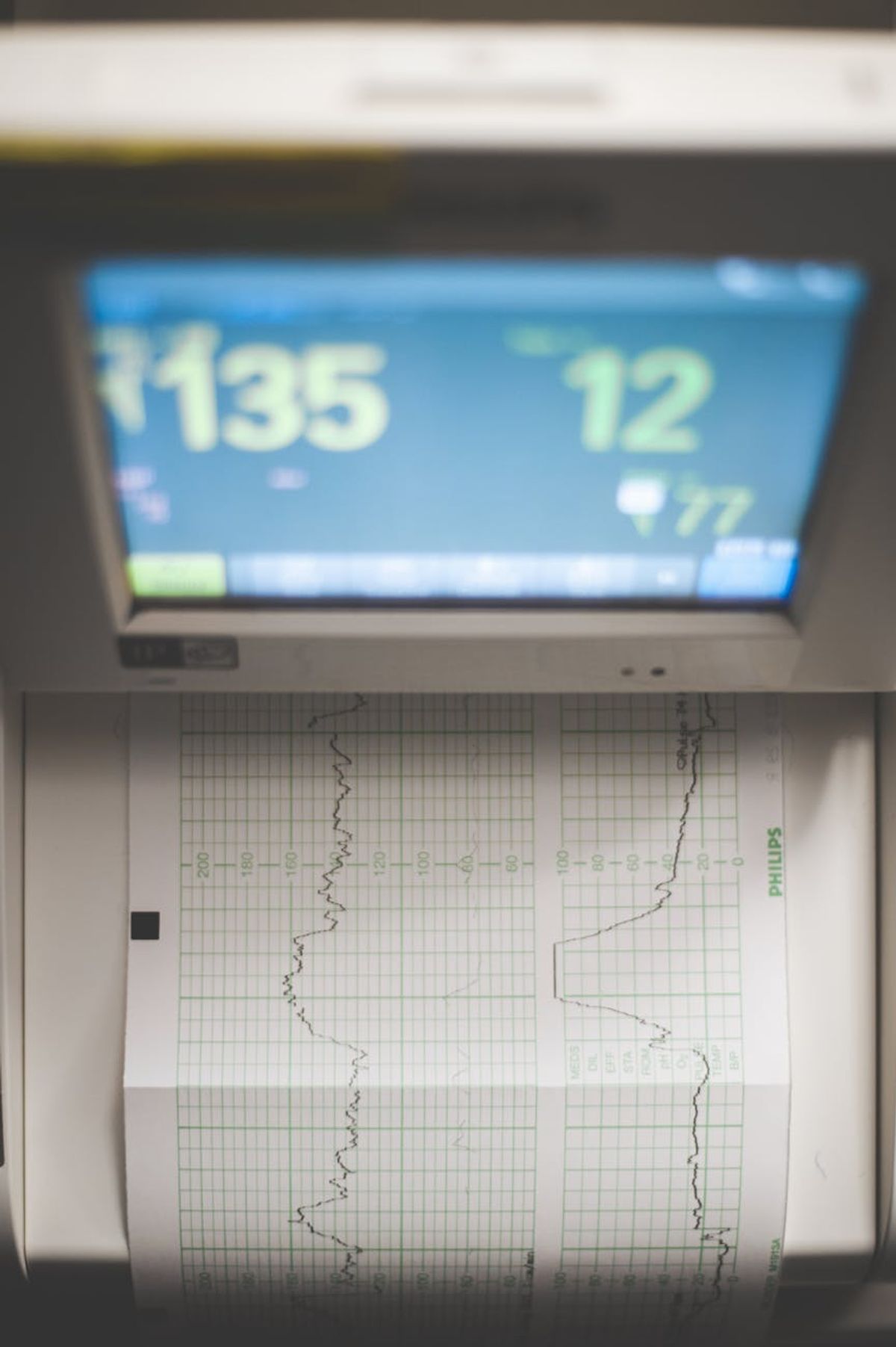 High-resolution image of a medical ECG machine showing heart rate data.