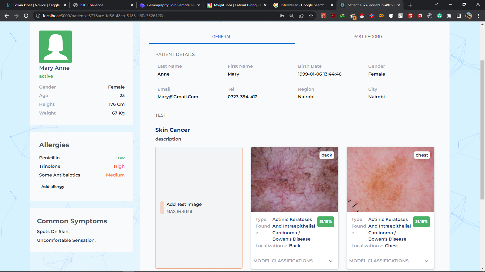 Skin cancer Detection System