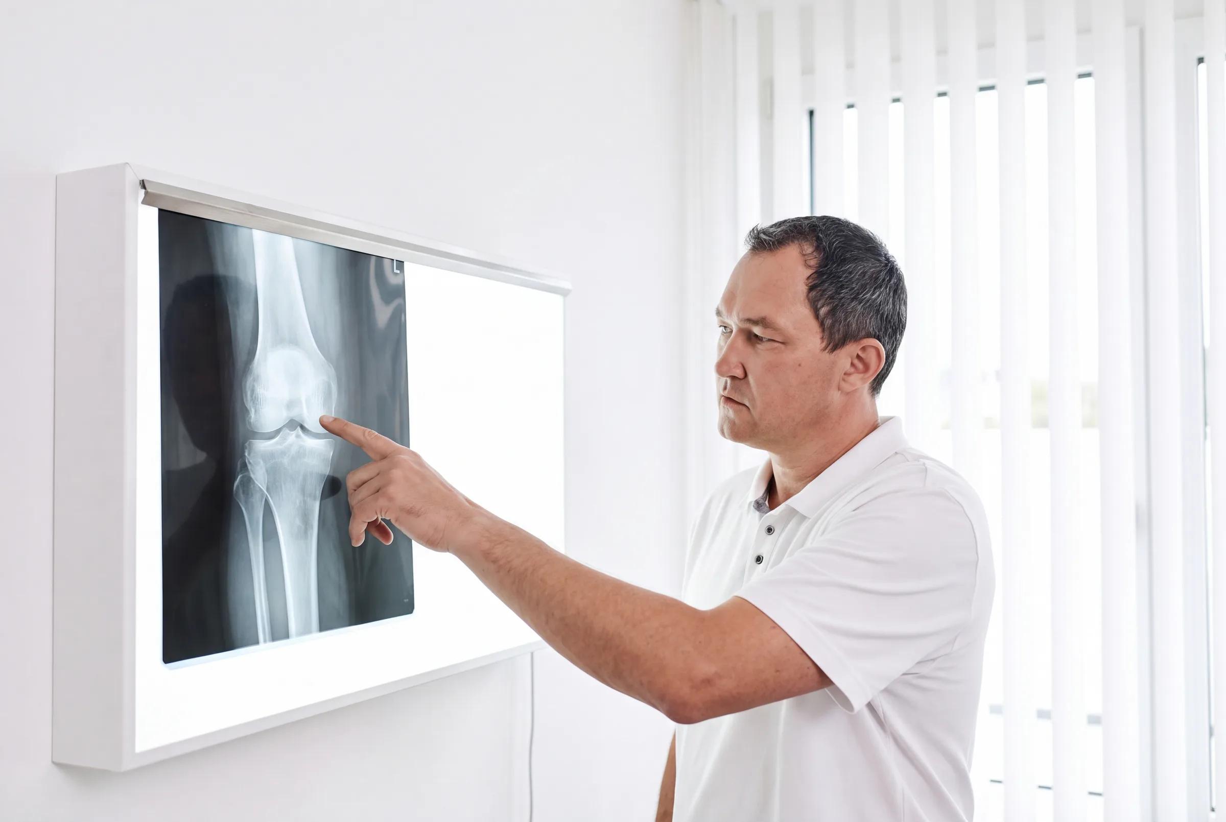 Orthopäde befundet eine Röntgenaufnahme des Kniegelenks am beleuchteten Röntgen-Betrachter in der Praxis