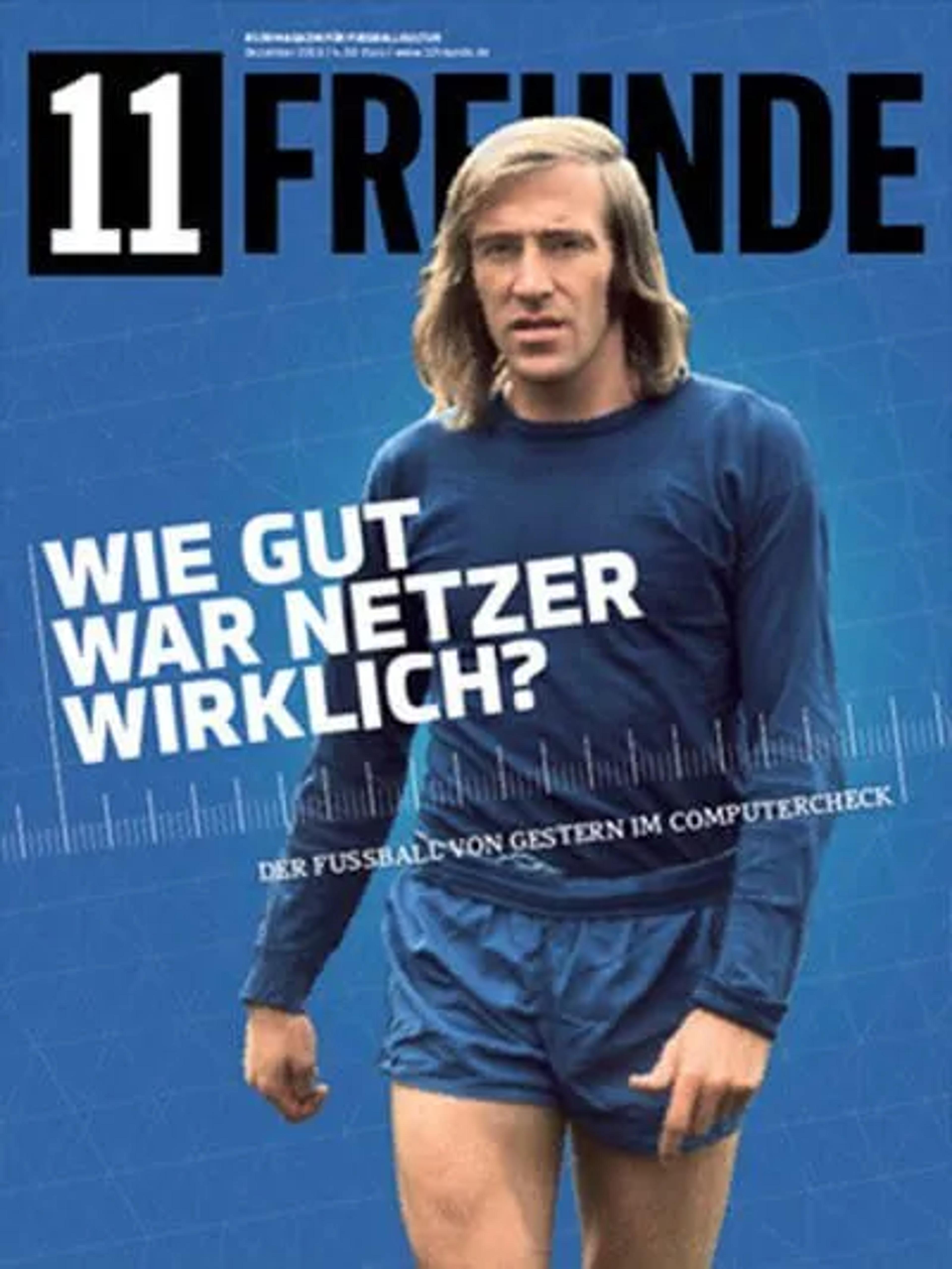 Die Orbitalbodenfraktur