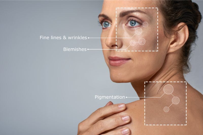 multiple signs of aging can appear on the skin at once