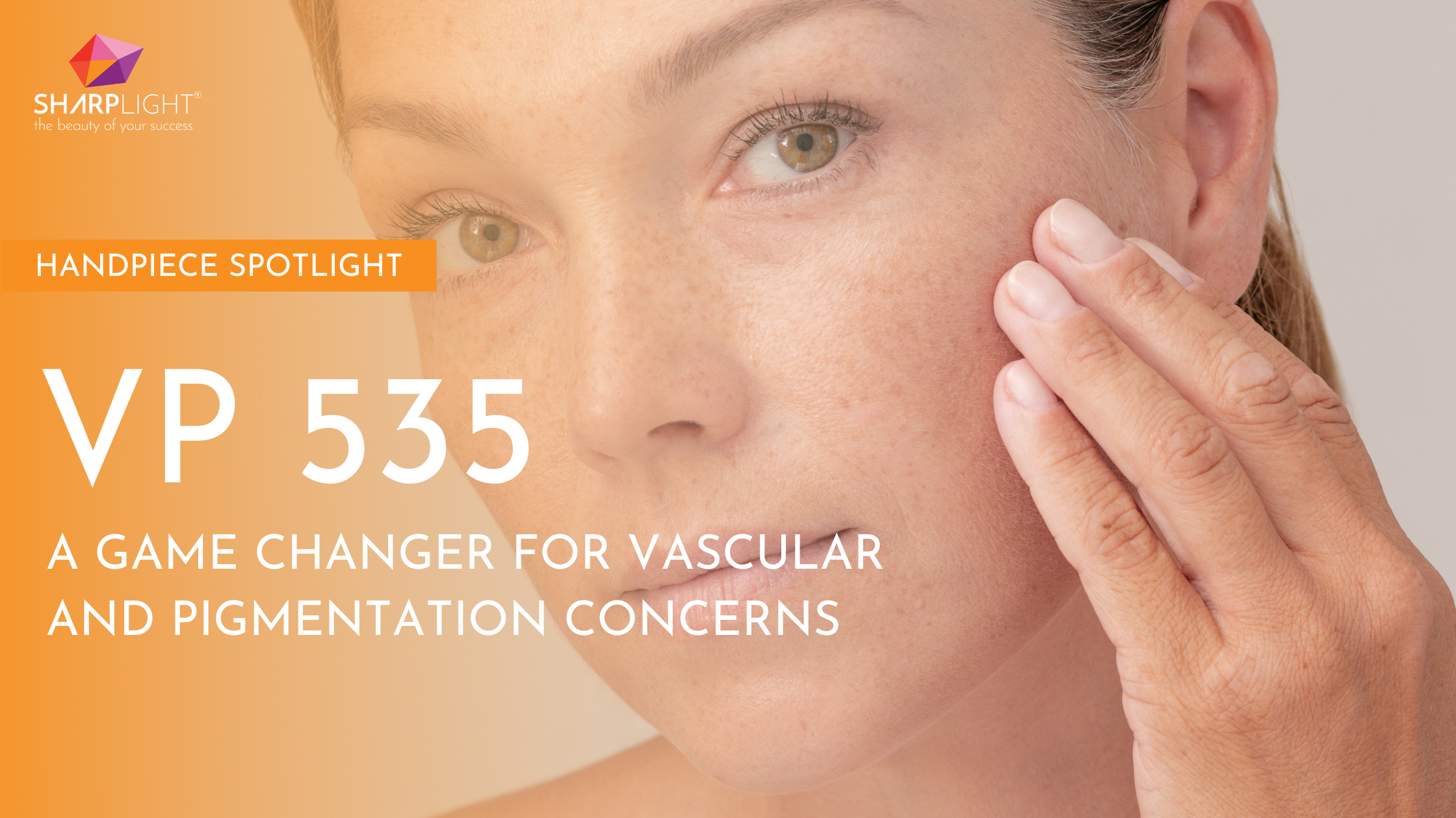 Handpiece SpotLight: VP 535 – A Game Changer for Vascular and Pigmentation Concerns