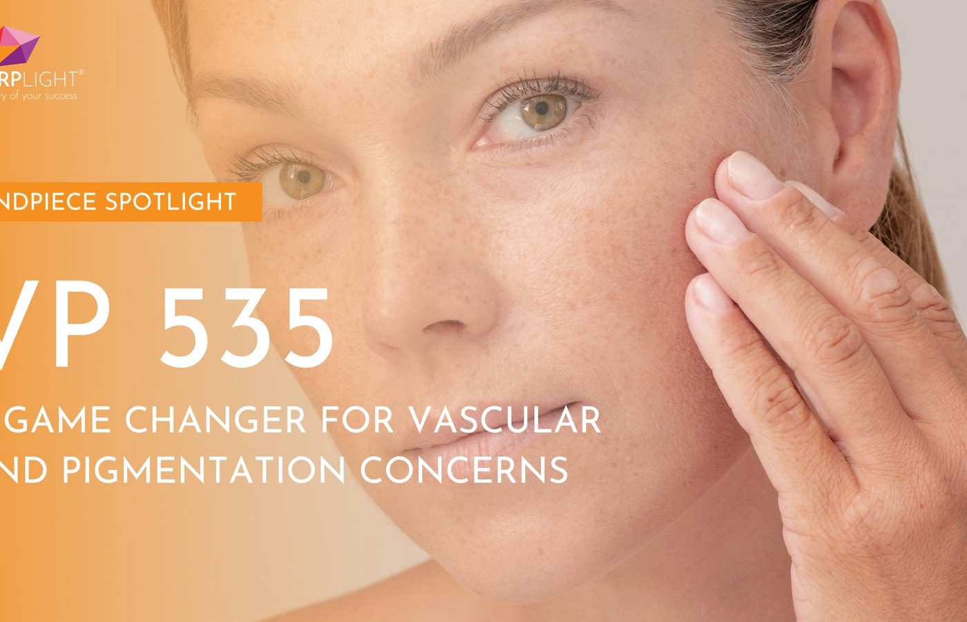Handpiece SpotLight: VP 535 – A Game Changer for Vascular and Pigmentation Concerns