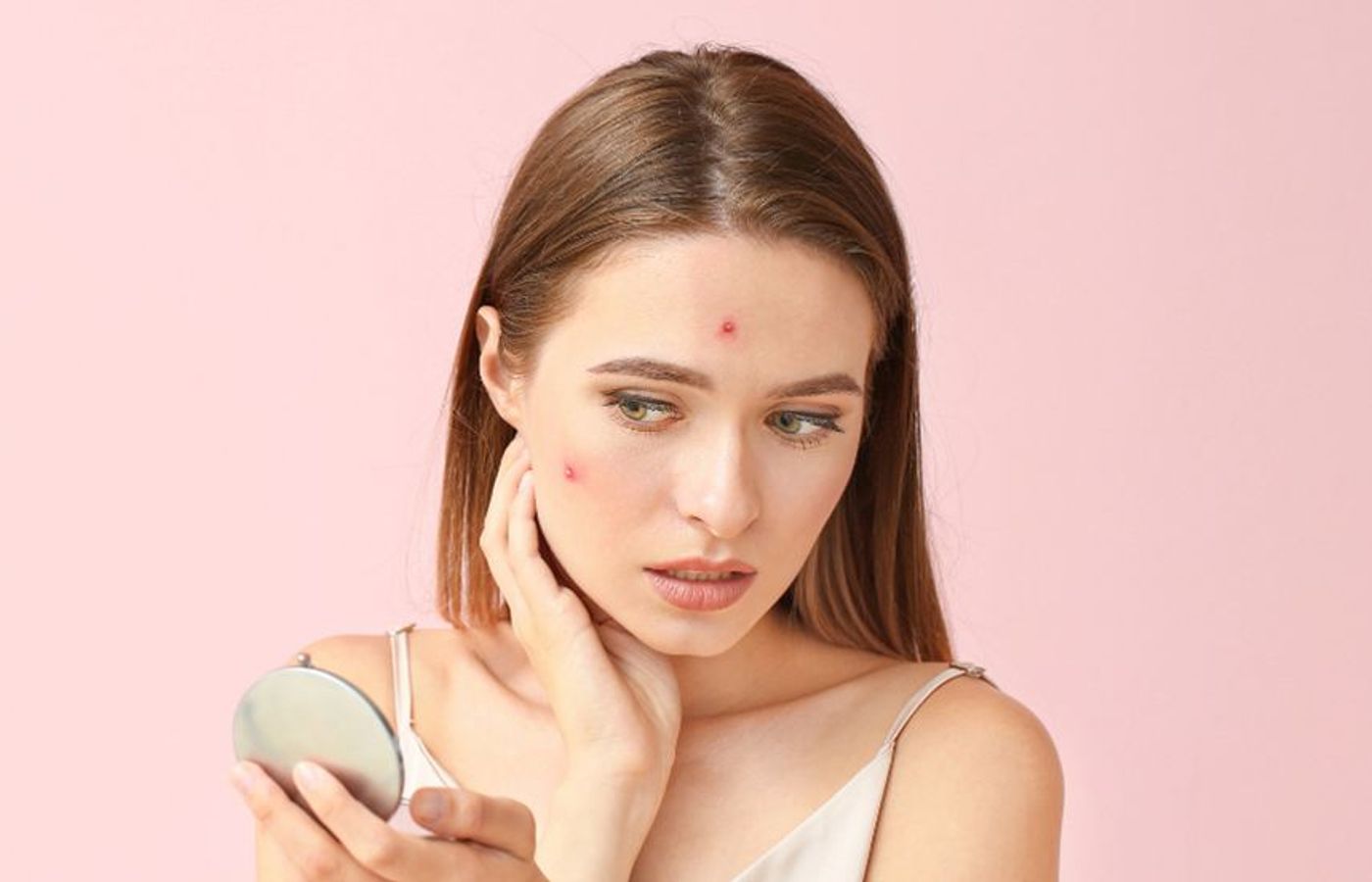 acne treatments