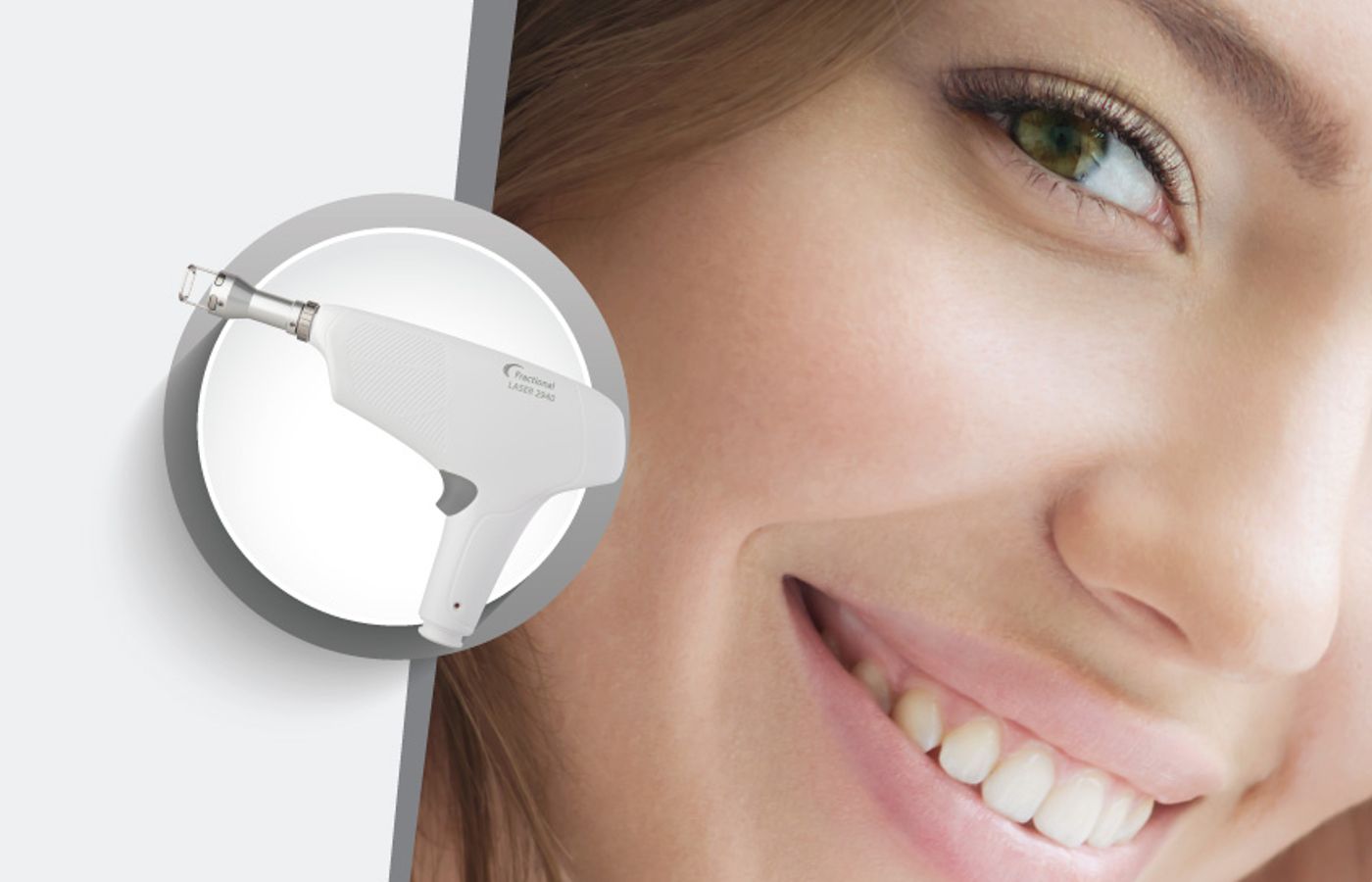 Handpiece SpotLight: Er:YAG 2940 nm Fractional Laser