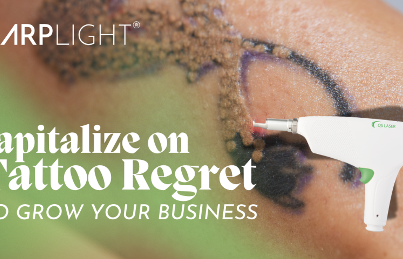 Laser Tattoo Removal: Capitalize on Tattoo Regret to Grow Your Business