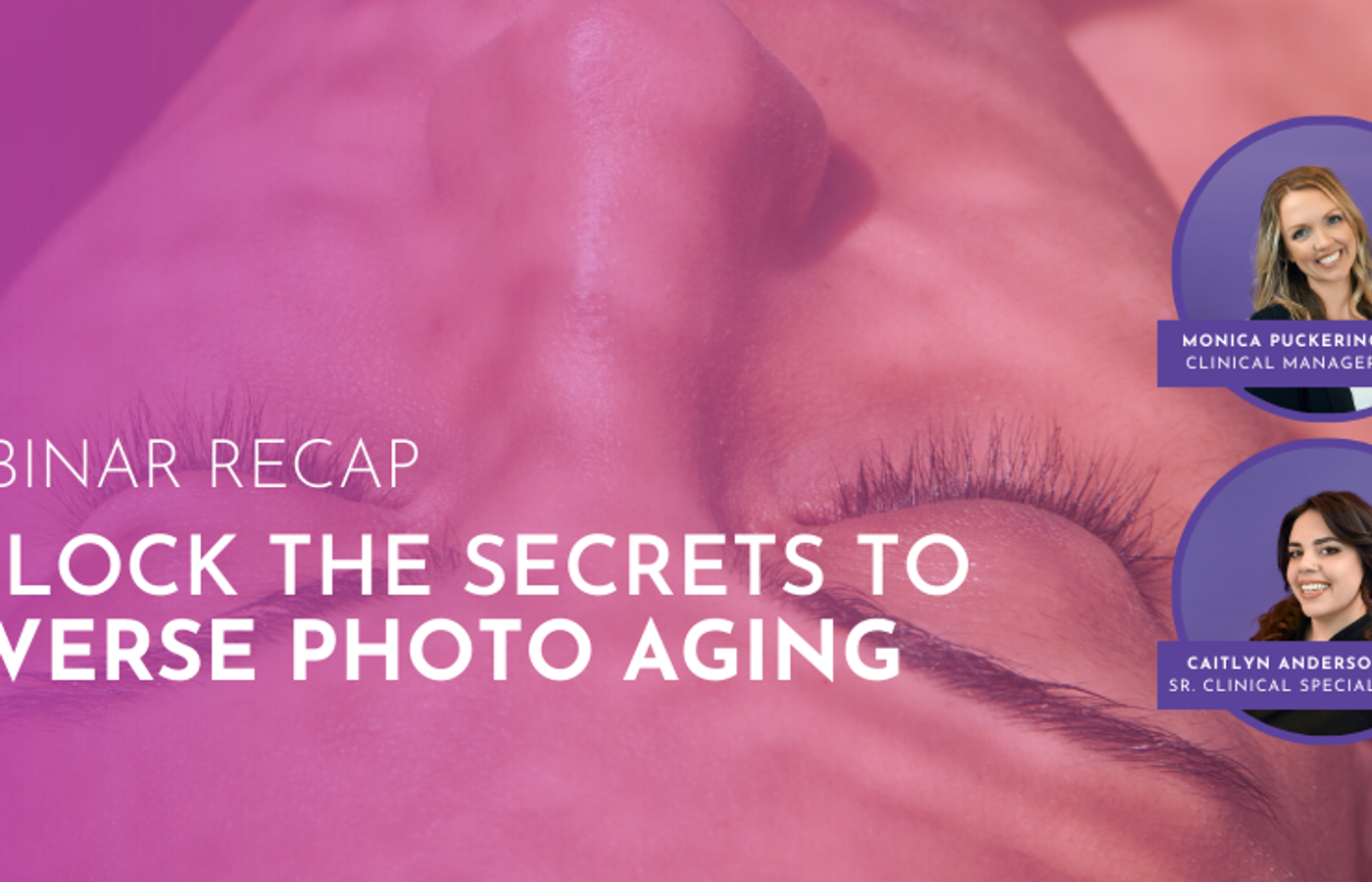 Webinar Recap: SharpLight’s Clinical Webinar Series – Unlock the Secrets to Reverse Photoaging
