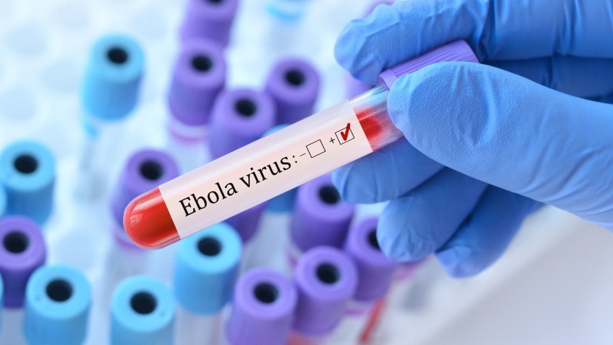 Es una enfermedad viral grave y altamente letal que provoca fiebre hemorrágica. 