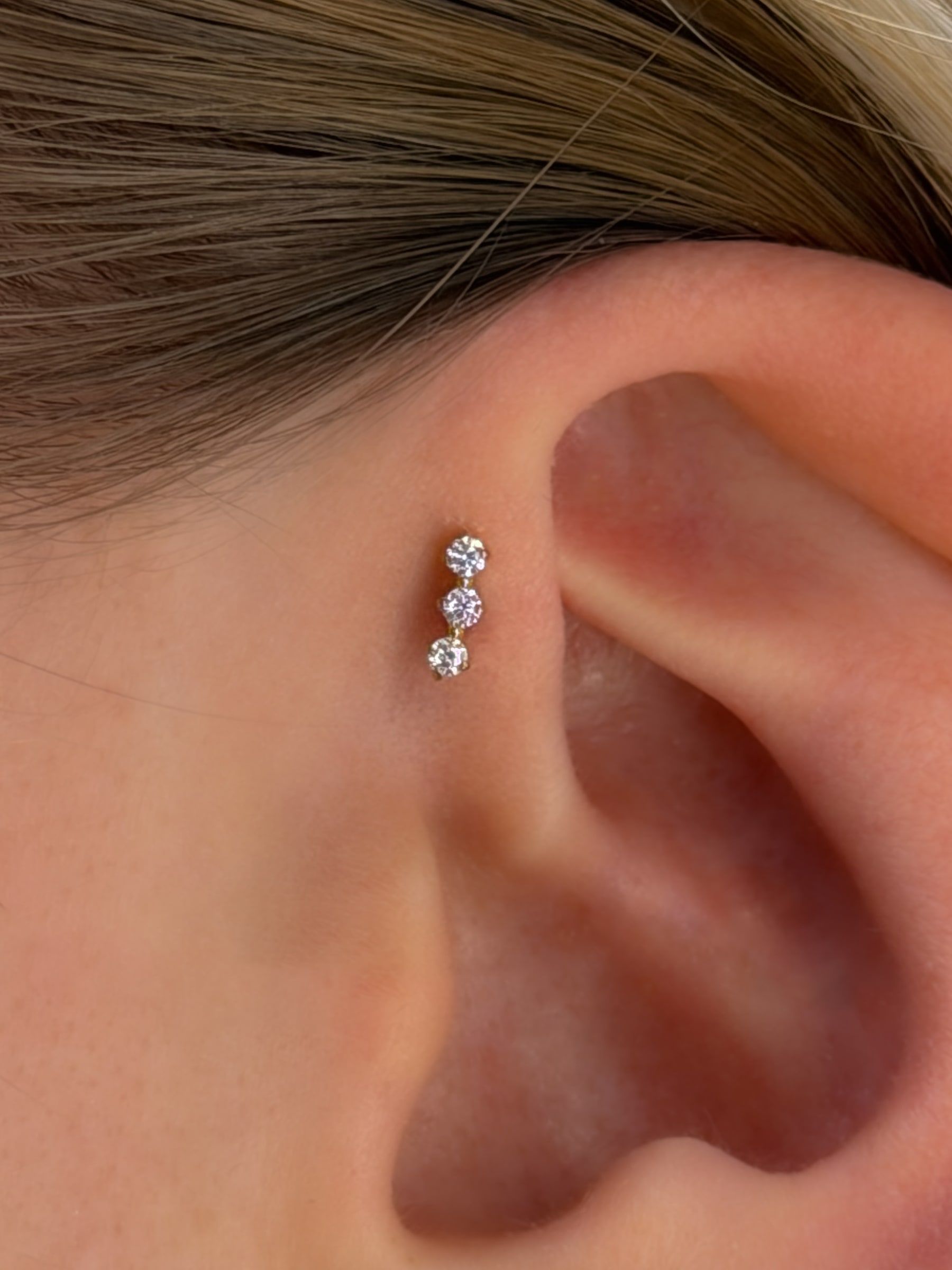 Forward helix