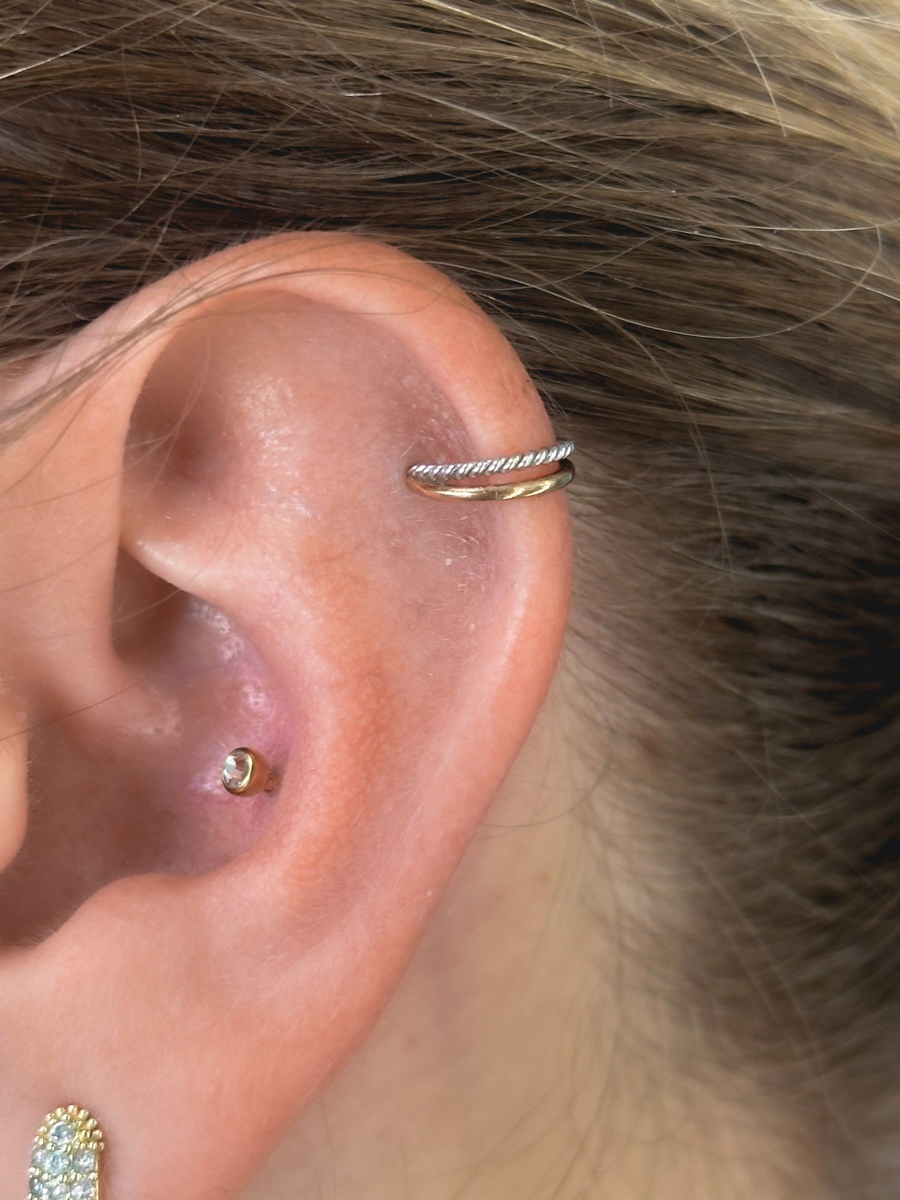 Helix a conch