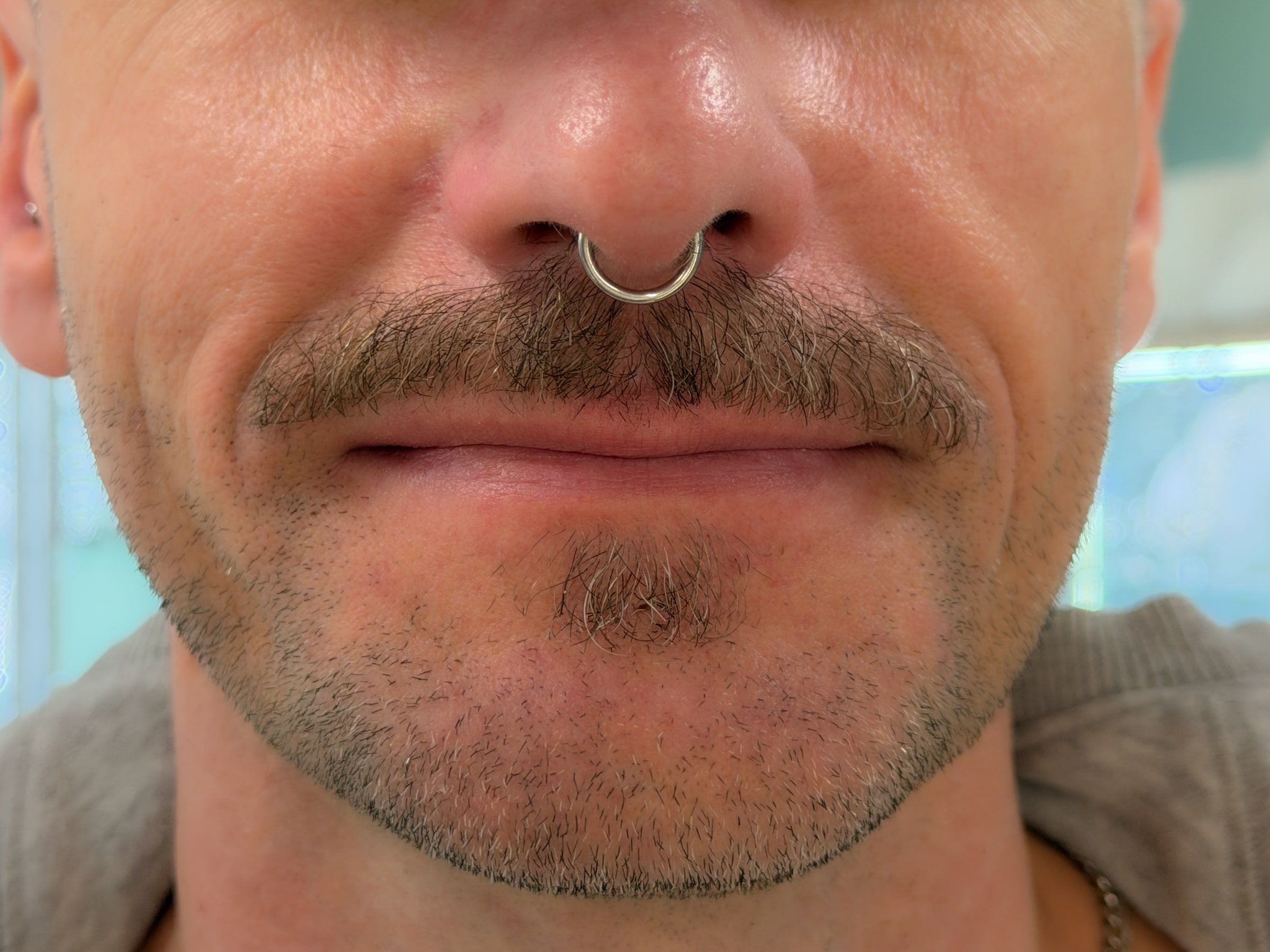Septum krúžok