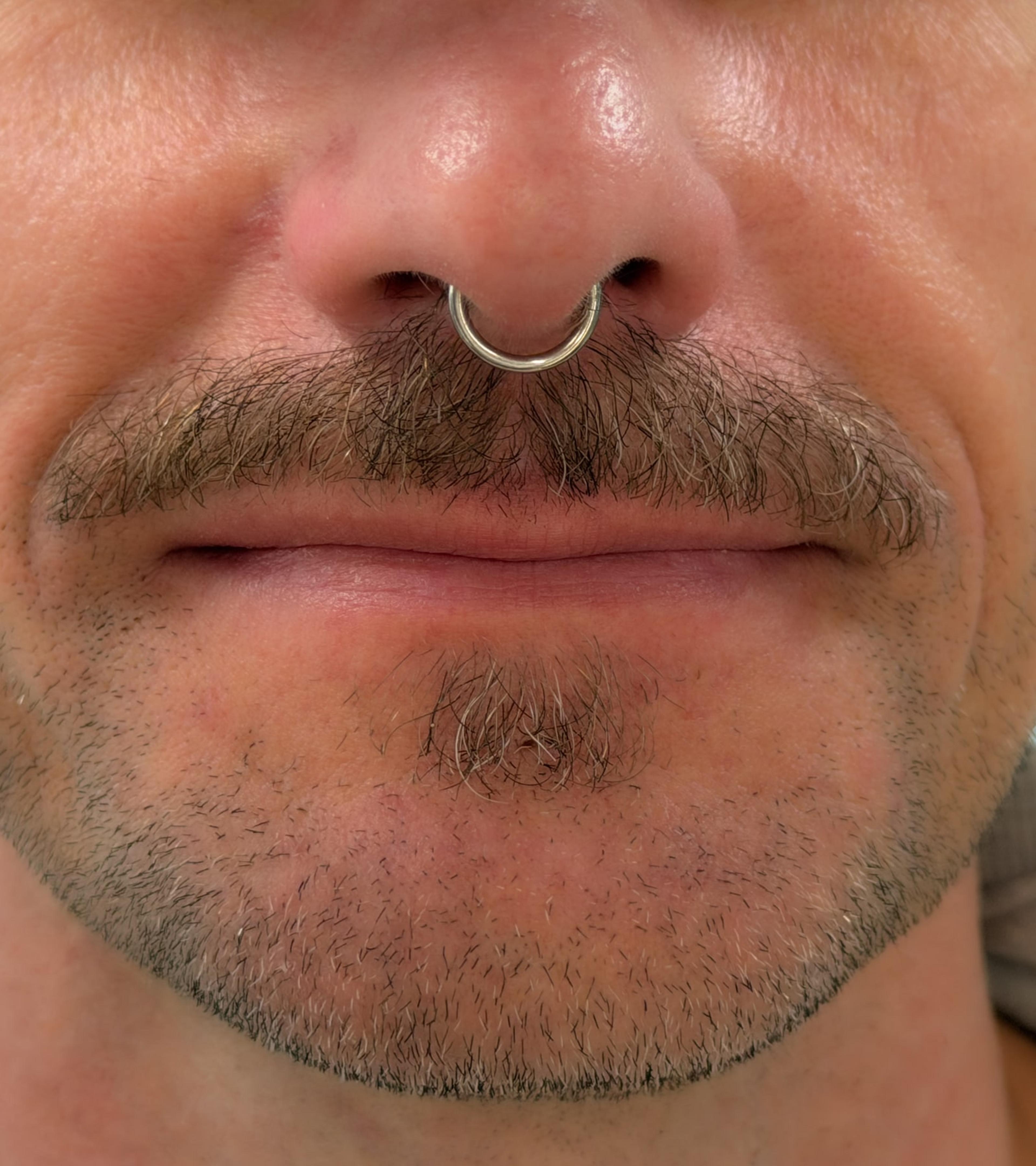 Septum krúžok