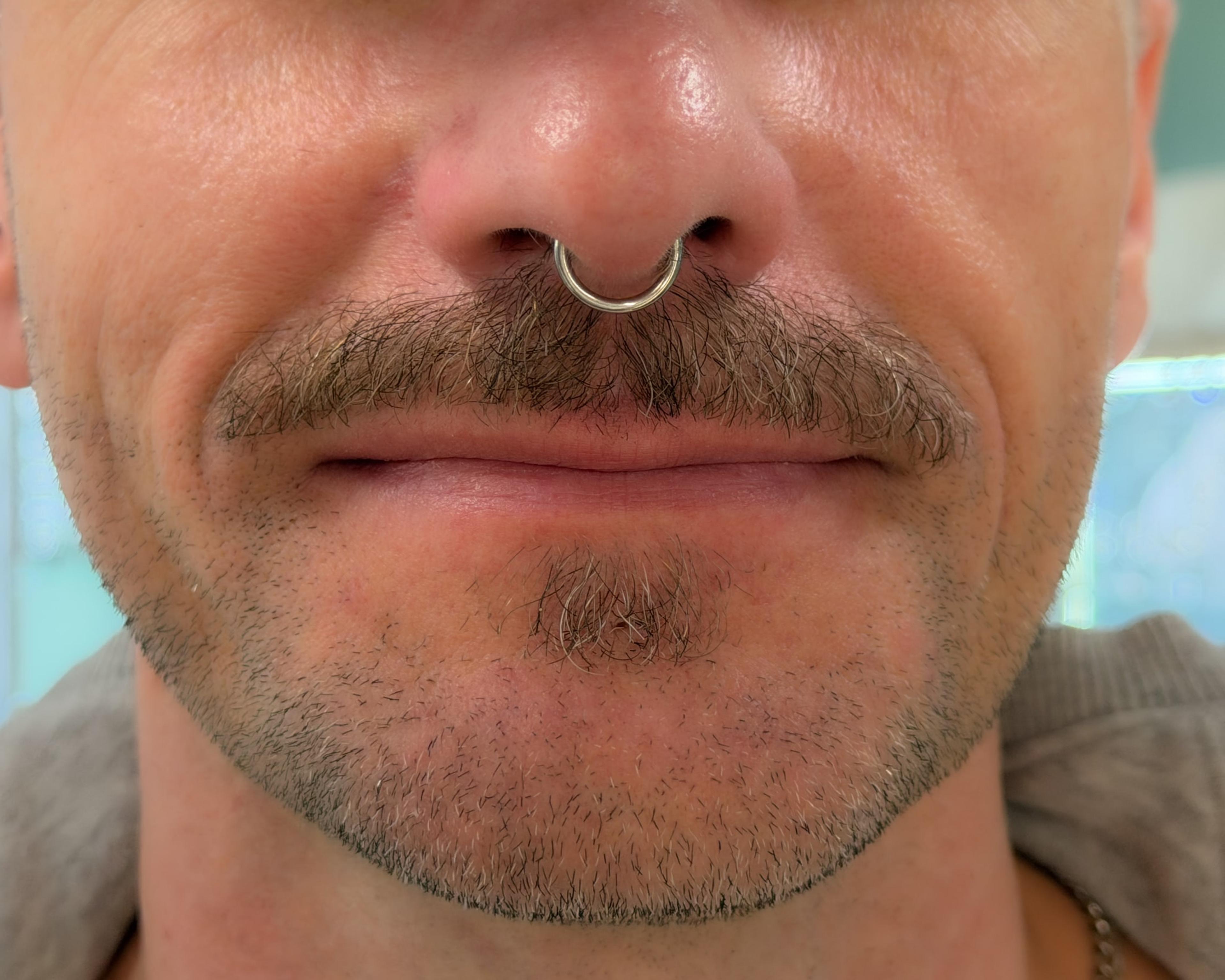 Septum krúžok
